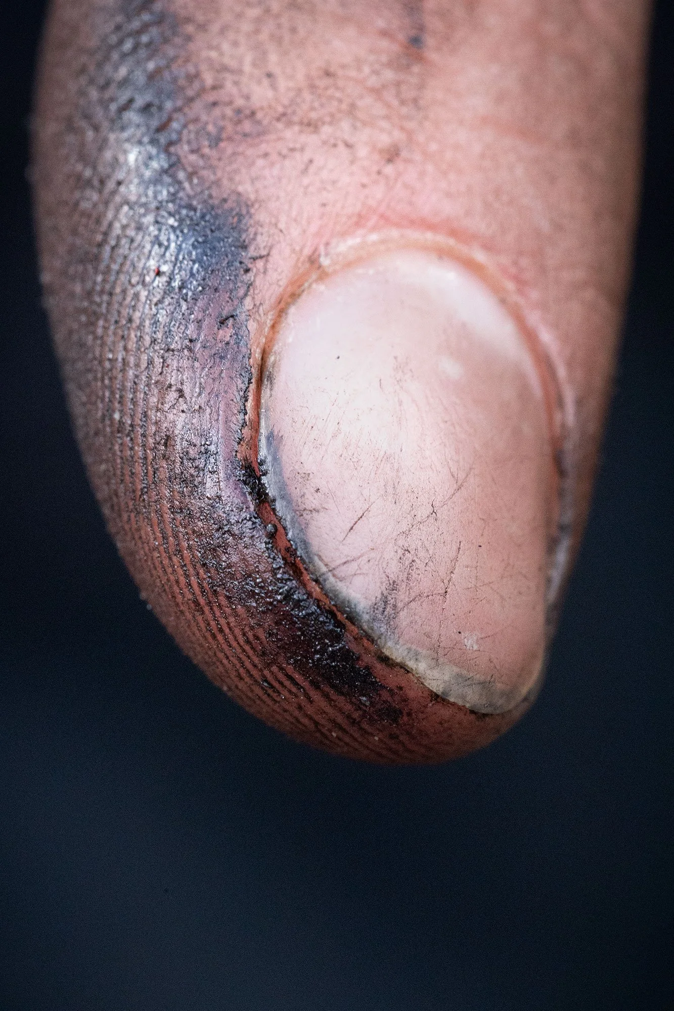 Close-up image of a dirty, injured fingerprint on a skin surface, with some black smudges and blood around the wound.