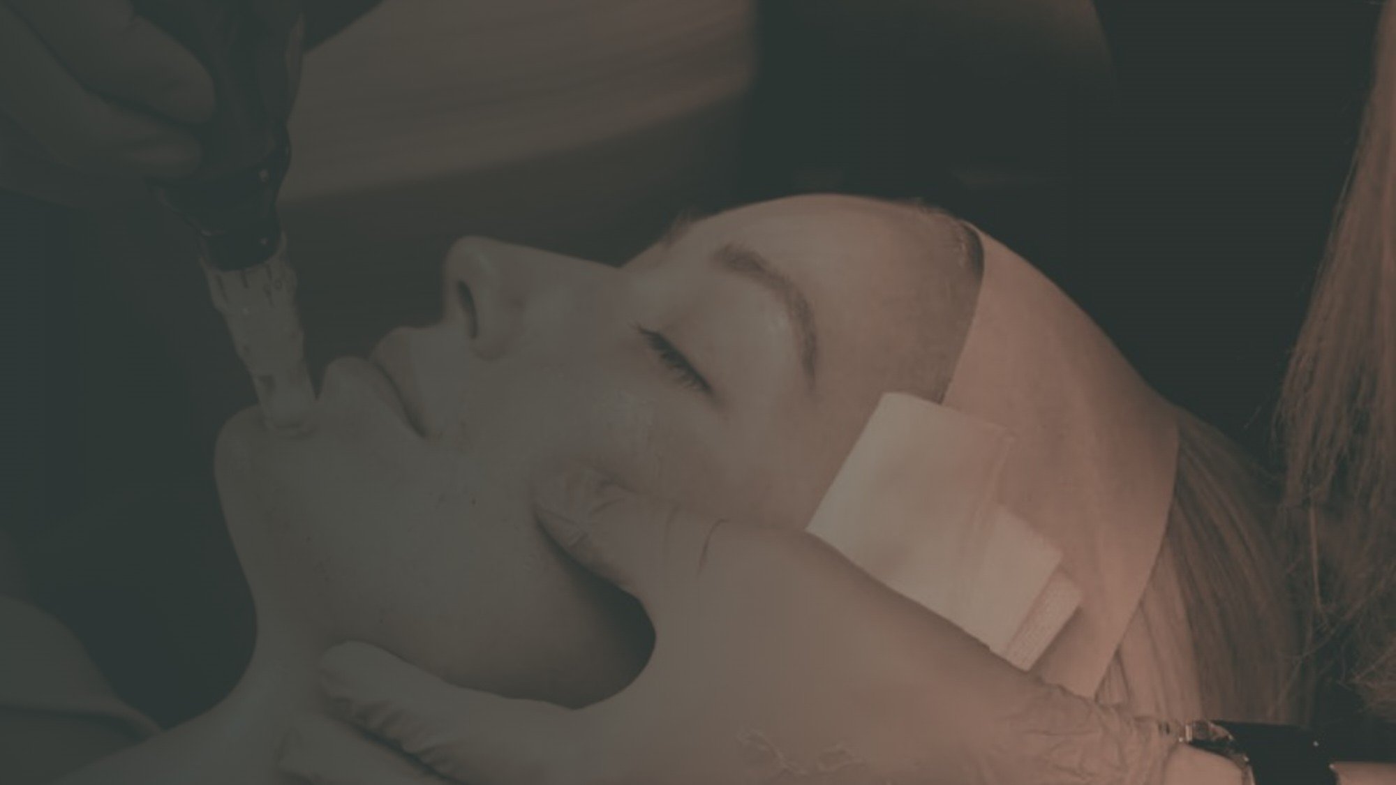 Client receiving a professional SkinPen microneedling treatment for skin rejuvenation at Covent Garden Skin Clinic.