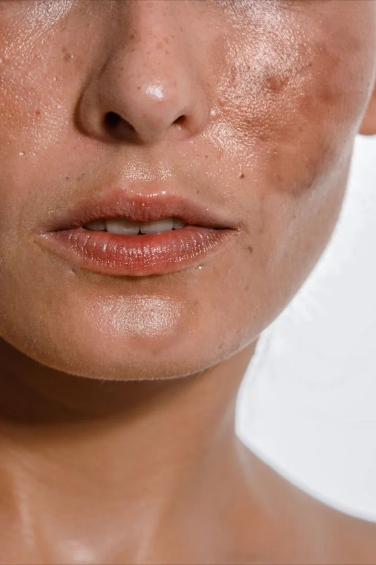 lets talk pigmentation