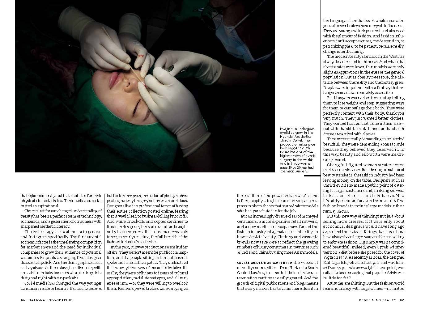 A magazine spread featuring text and a photo of a person receiving eyelid surgery.