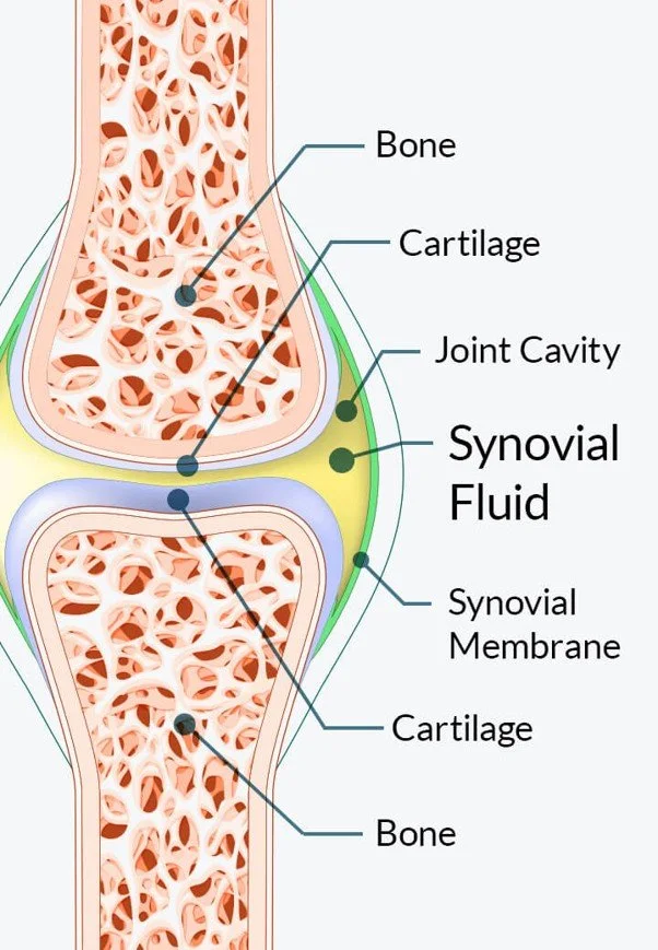 Diagram of a joint showing bone, cartilage, joint cavity, synovial fluid, synovial membrane, and bone.