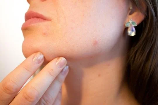 Treatment for Hormonal Issues