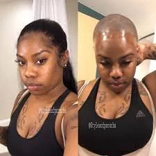 Natural Touch Medical Wigs for Chemo and Alopecia Patients