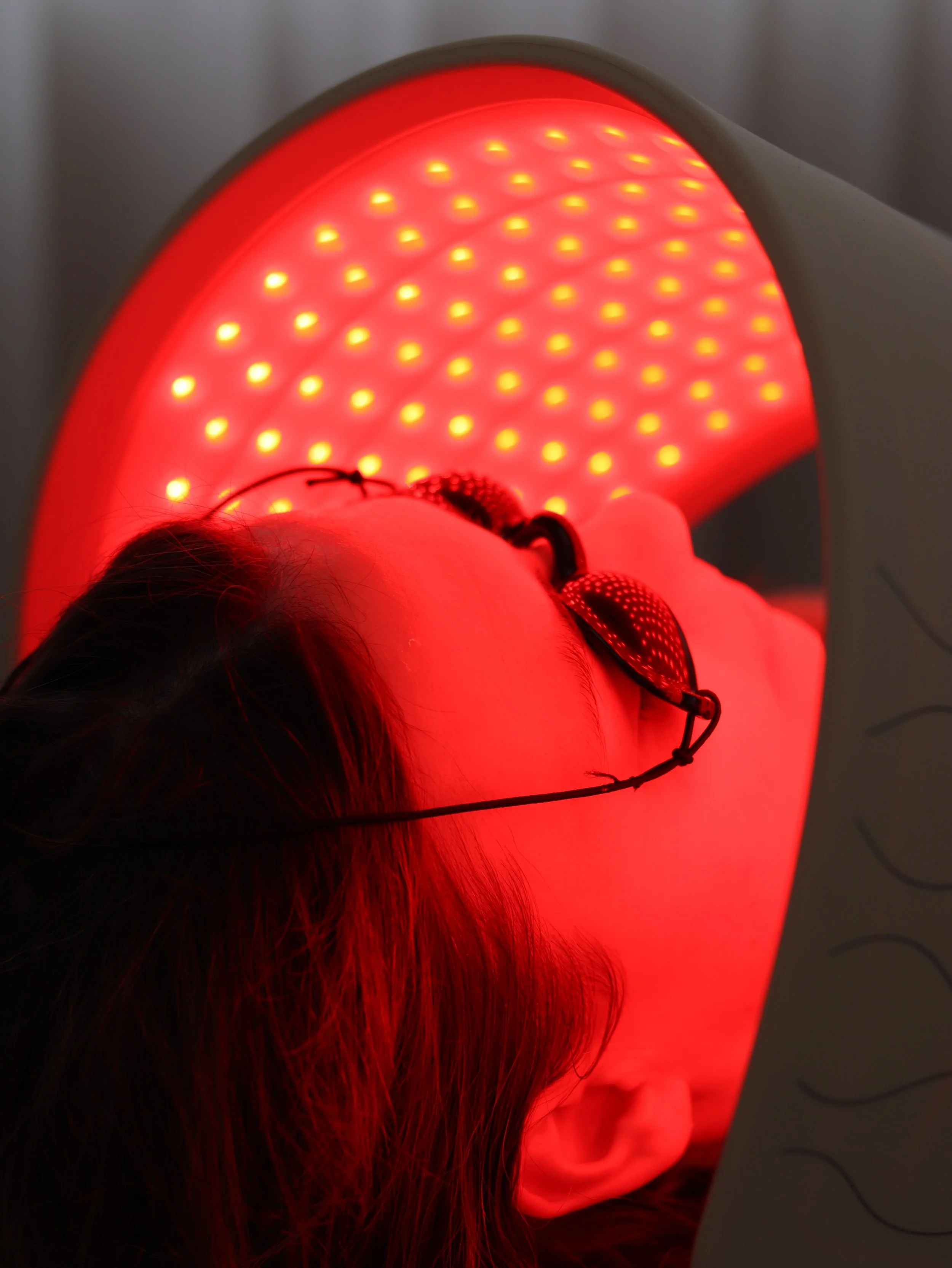Person undergoing red LED light therapy on face, lying down with protective goggles, in a medical or spa setting.