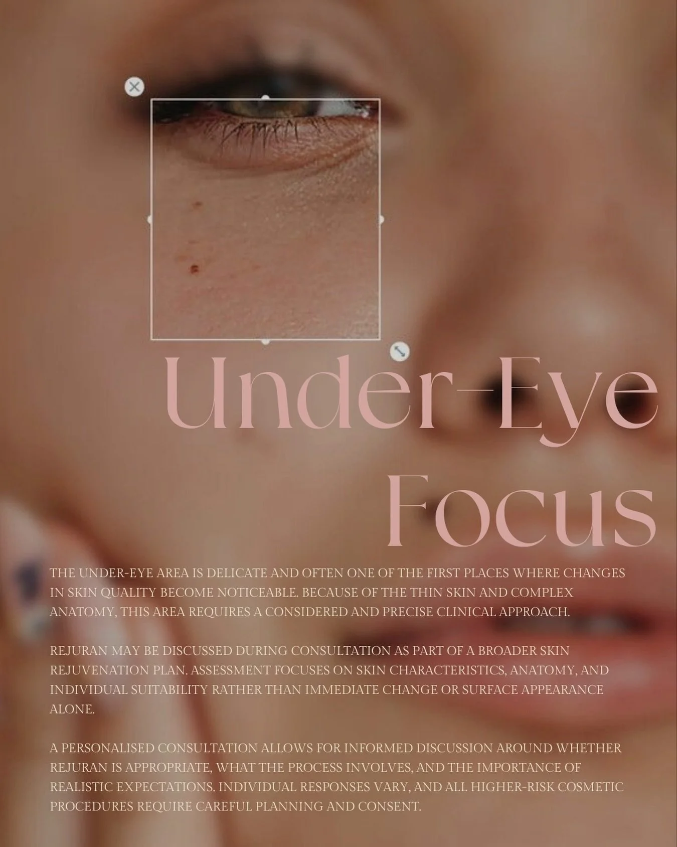 The skin is thin, the anatomy is complex, and it needs a slow, considered approach.

Rejuran may come up in a consultation as part of a wider skin plan. I look at your skin, your anatomy and whether it&rsquo;s suitable for you, not just what you see 