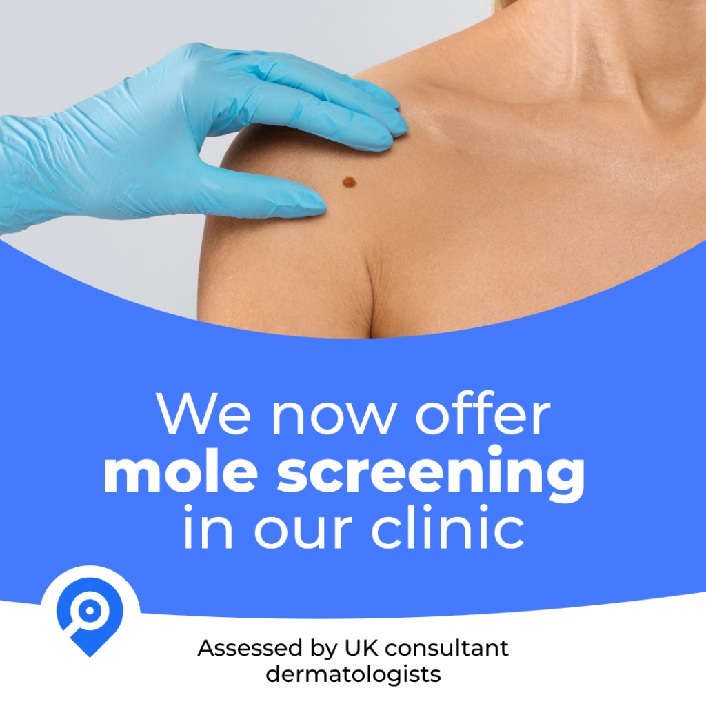 Close-up of a woman's shoulder with a mole on her skin, a healthcare professional wearing a blue glove is gently examining the mole, and a blue banner with white text advertises mole screening at a clinic.