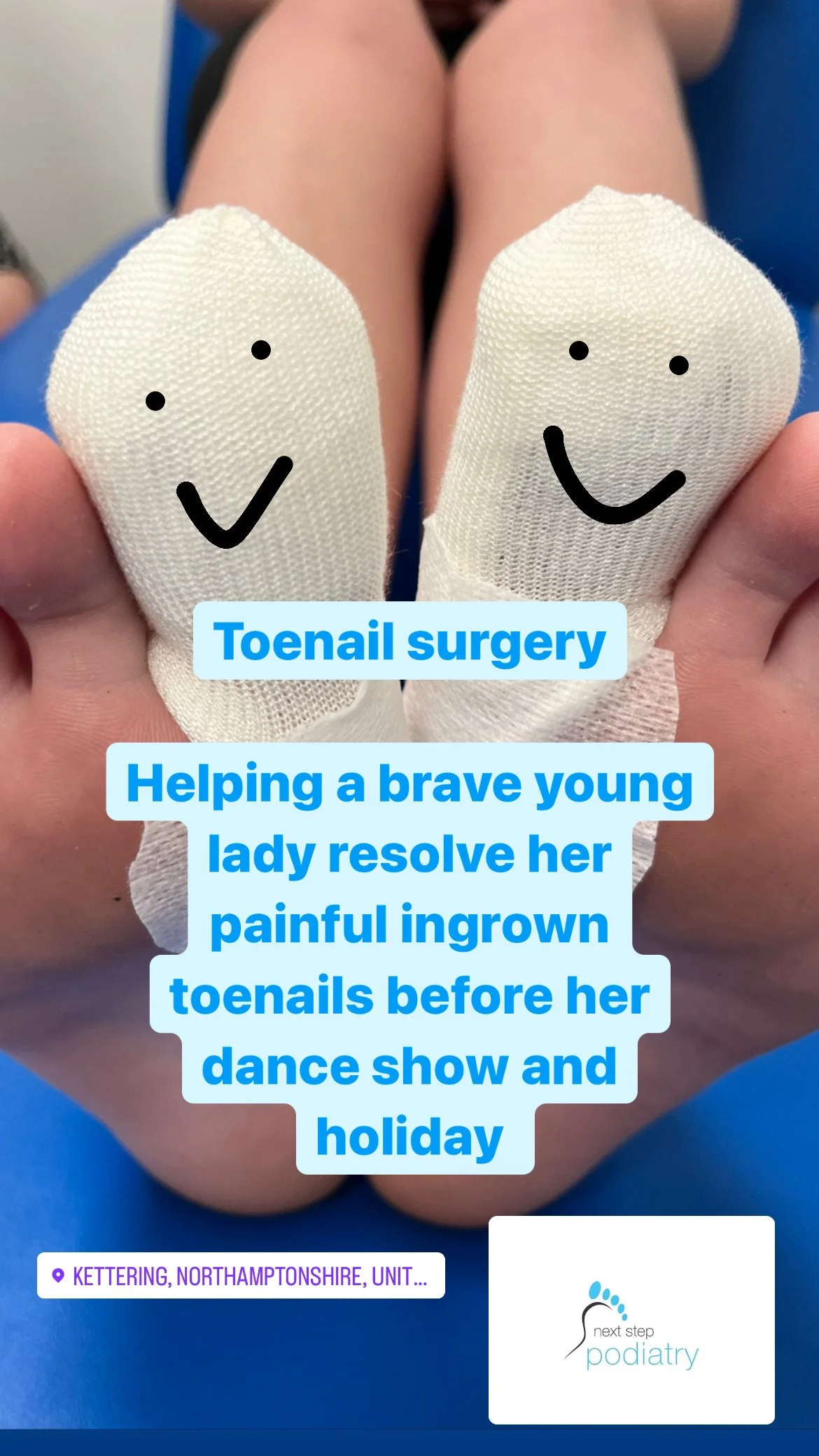 Close-up of two toes with bandages on the toenails, each bandage has a happy face drawn on it. Text overlay about toenail surgery and recovering from ingrown toenails before a dance show and holiday.