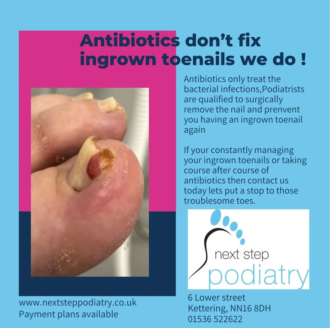 A flyer from a podiatry clinic explaining that antibiotics do not fix ingrown toenails and encouraging people to seek professional treatment to remove ingrown toenails, with a close-up image of a toenail with an infected ingrown nail.