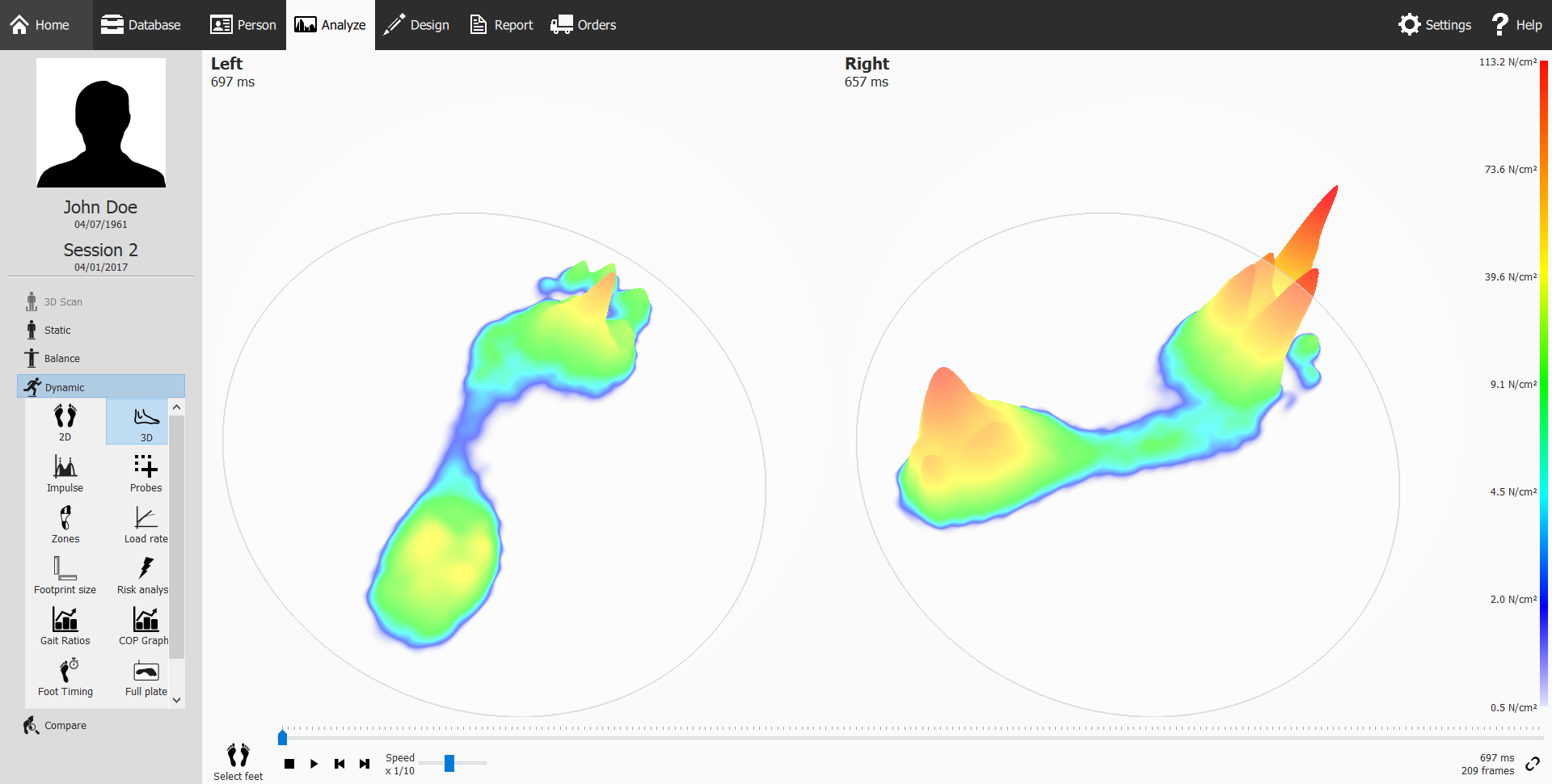 Foot pressure analysis screenshots showing two foot pressure distribution maps for the left and right foot, color-coded to indicate pressure intensity.