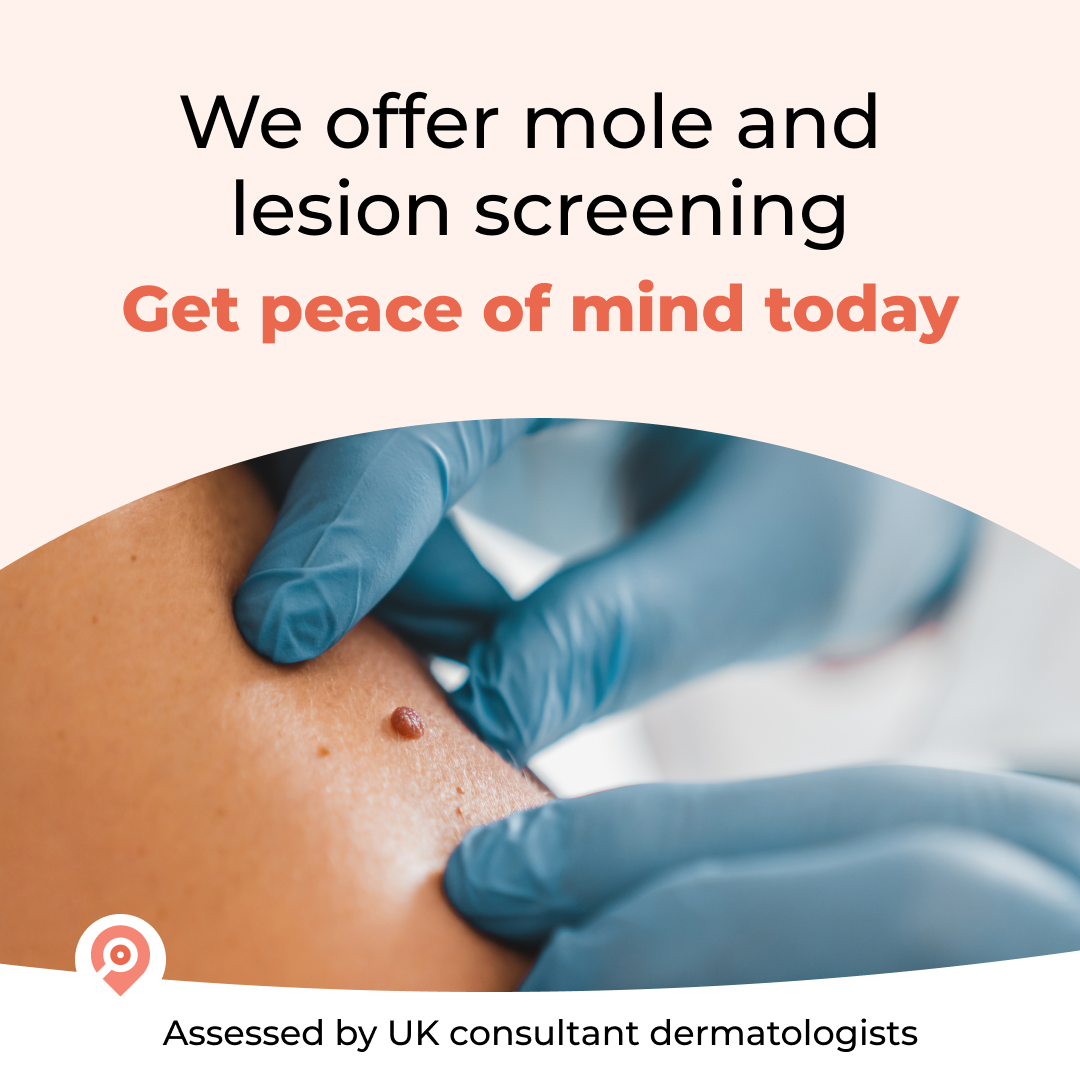 Close-up of a healthcare professional wearing blue gloves performing mole or skin lesion screening on a person's skin.