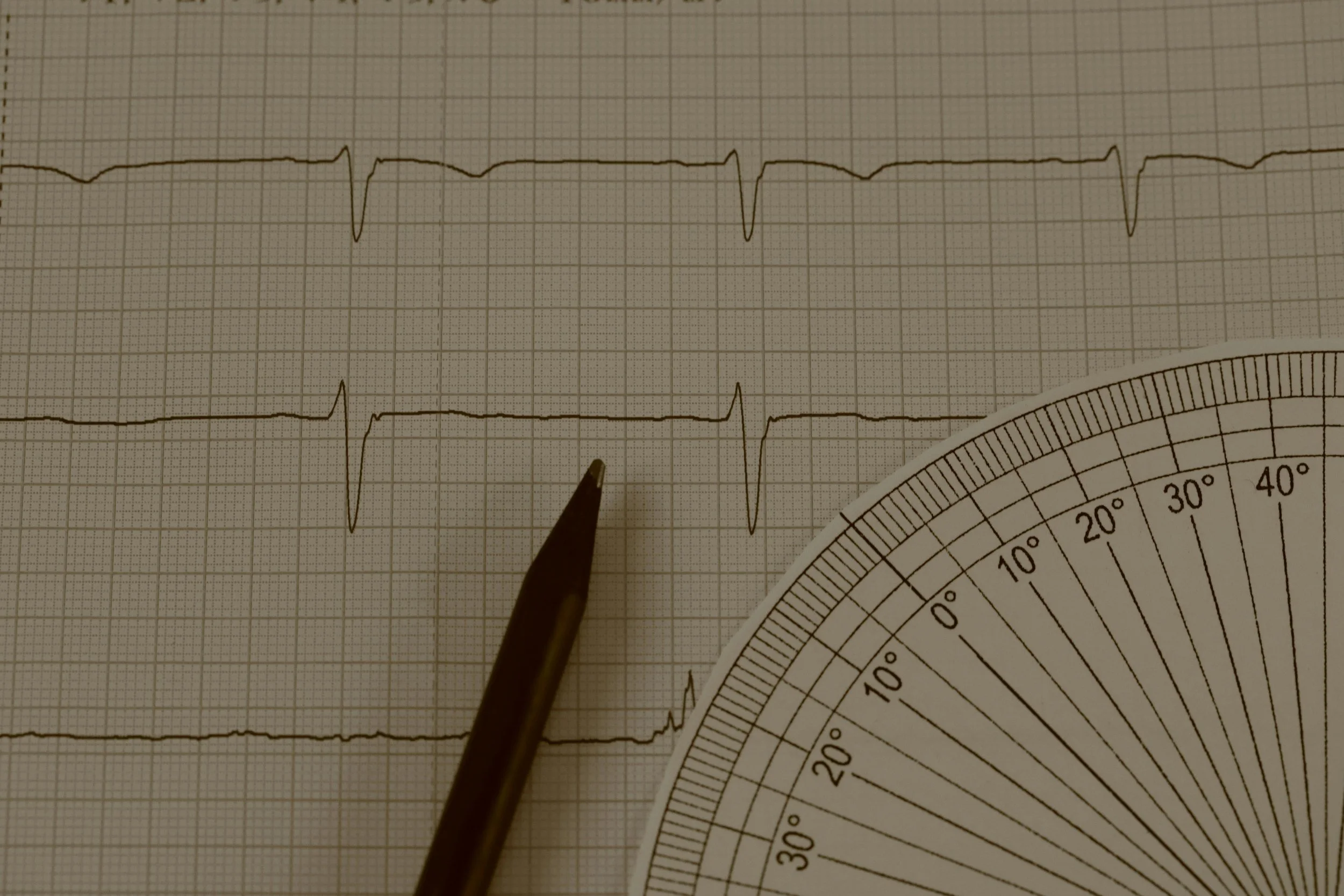 When You Can't Feel Anything Anymore: What Emotional Numbness in Burnout Really Is