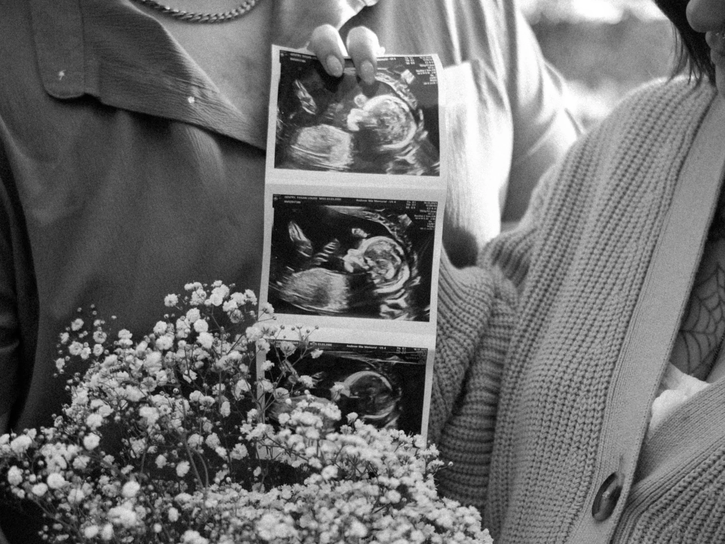 A pregnant woman holding an ultrasound image of her baby next to a bouquet of small white flowers.