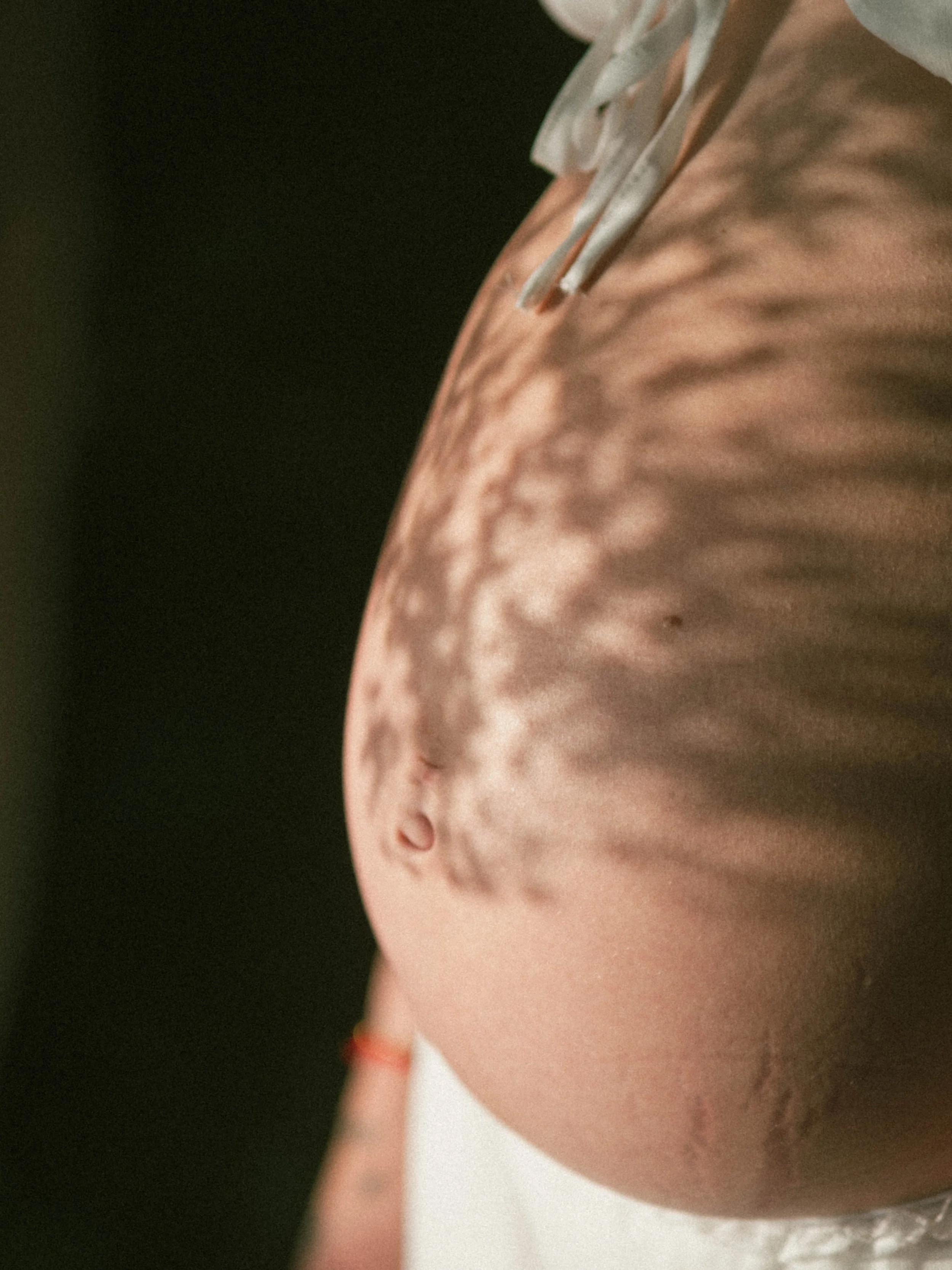 Close-up of a baby's face with some skin blemishes, looking slightly upward.