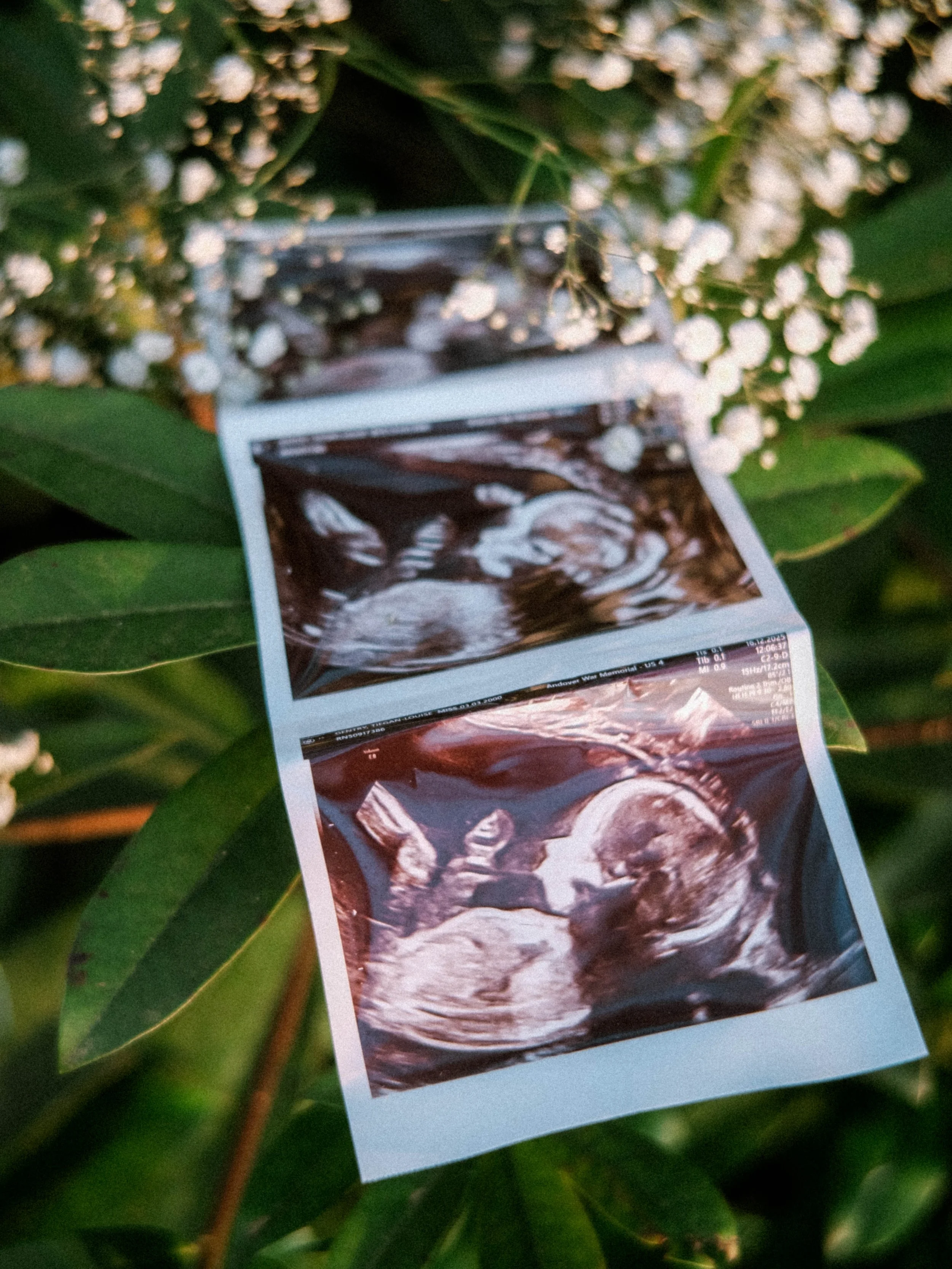 An ultrasound photo printed on paper, placed among green leaves and white flowers.