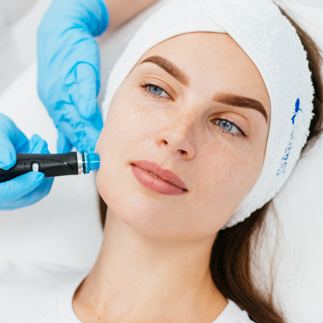 Medspa in Los Angles, CA 90048 l Microneedling Near Me