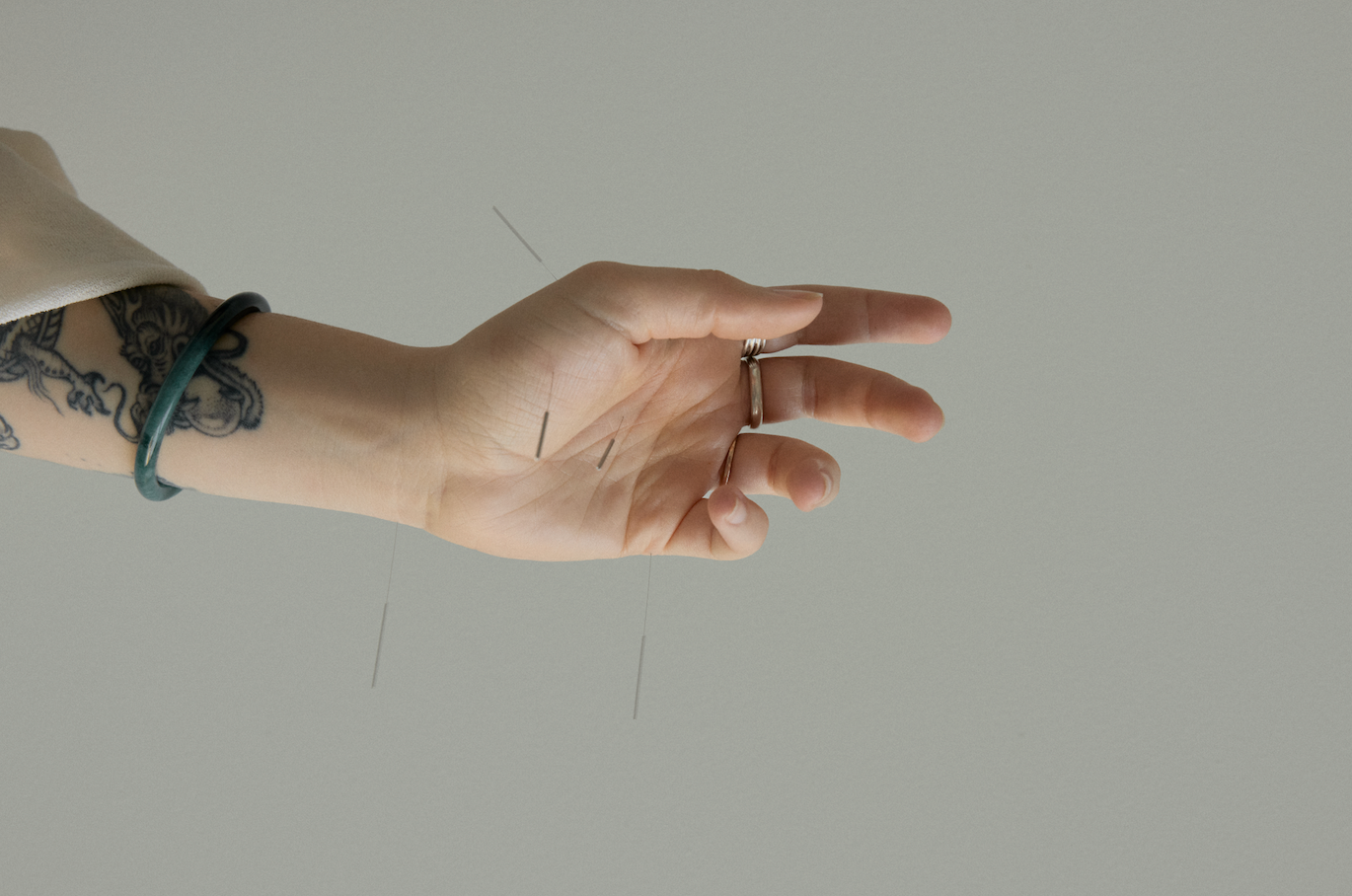 What we can treat with acupuncture and chinese medicine