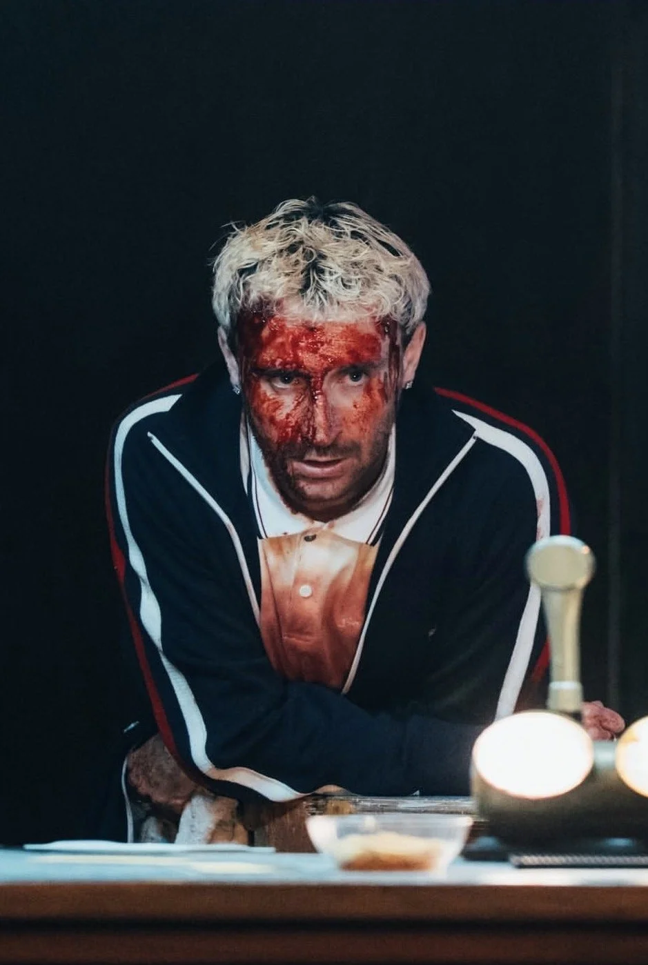 A man with platinum blonde curly hair and a partly blood-covered face, staring intently in front of him, leaning forward with his arms crossed on a table, with a dark background.