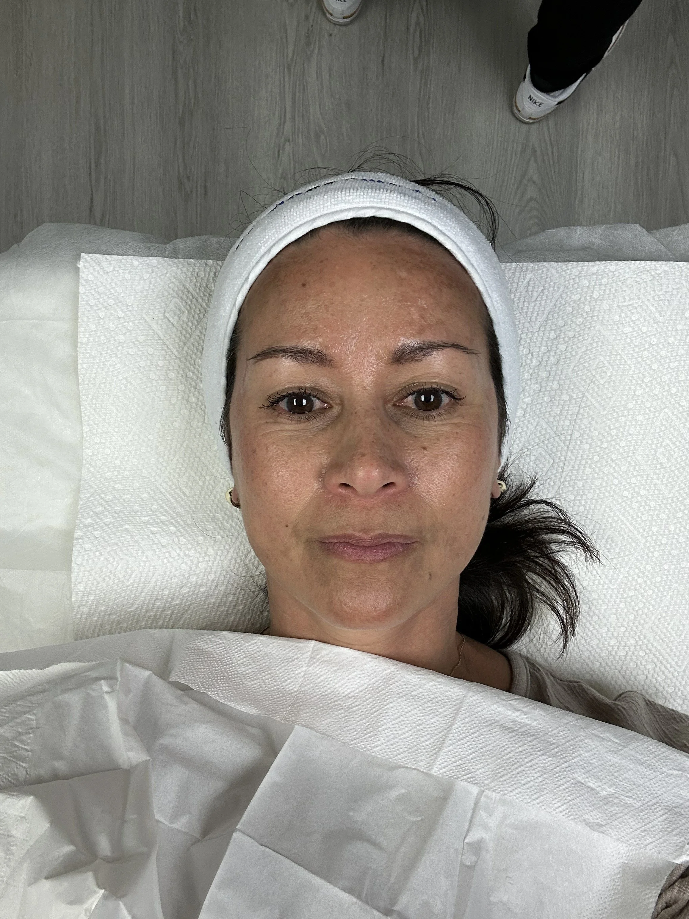 A woman lying down on a medical bed, looking up at the camera, with a white headband, and surrounded by white tissues or paper towels.