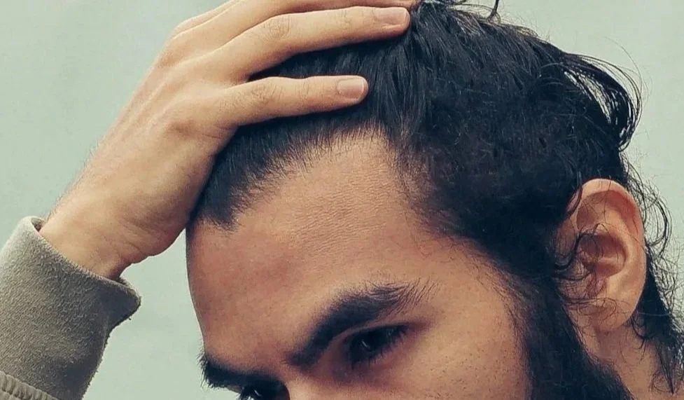 Close-up of a person's face and hand, showing dark, curly hair and a raised hand touching the forehead.