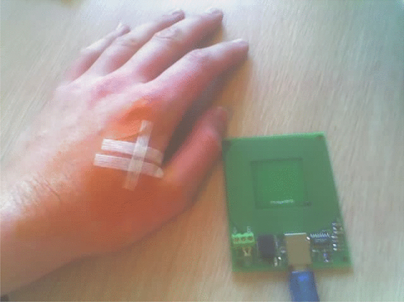 Social-technical issues facing the humancentric RFID implantee sub-culture through the eyes of Amal Graafstra