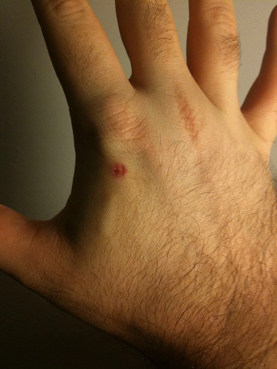 Perceived barriers for implanting microchips in humans: A transnational study