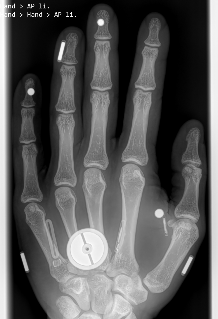 You Want to Do What with RFID?