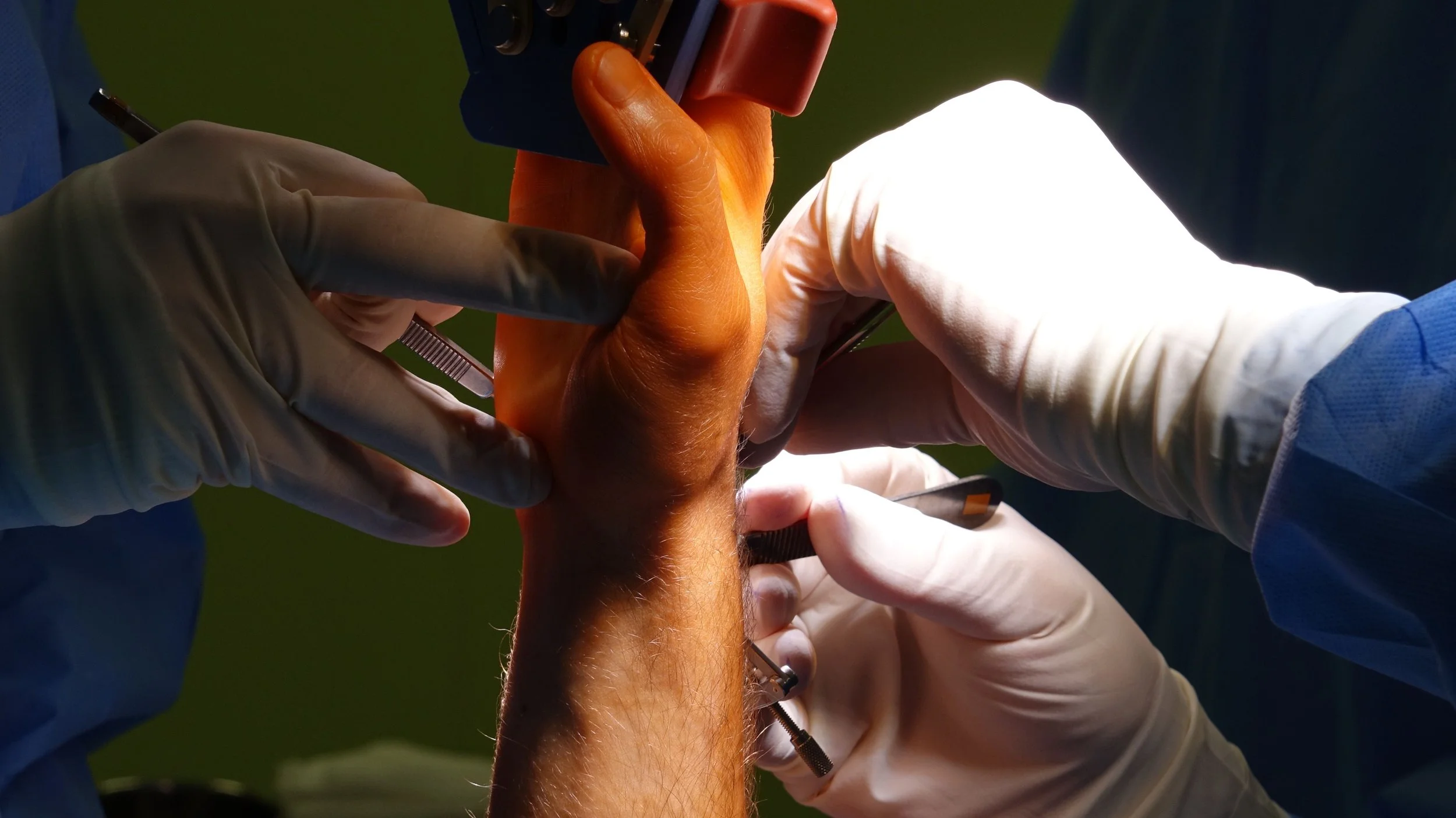 Implanted body technologies are already a reality