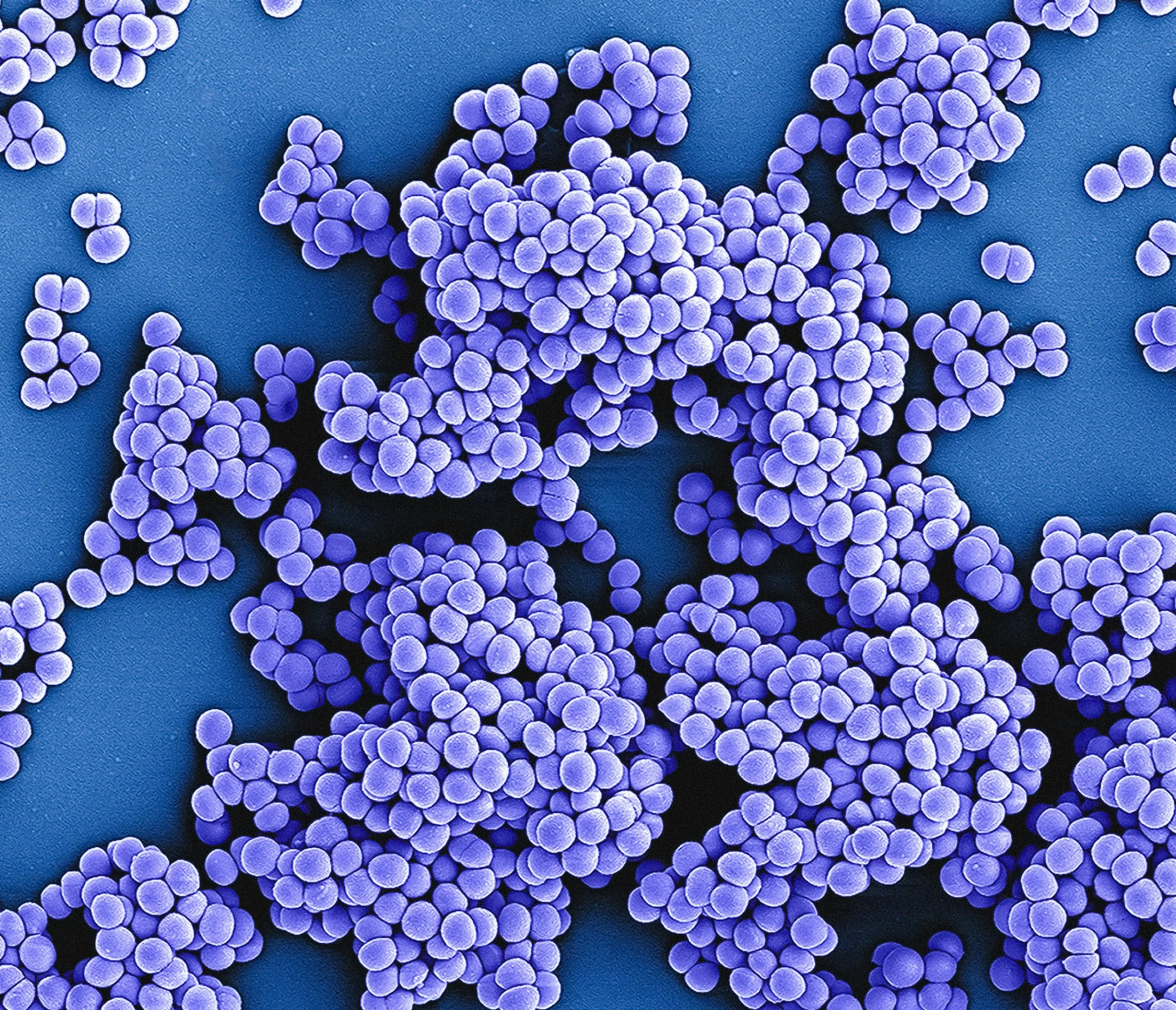 Close-up of numerous purple, spherical particles on a blue surface.