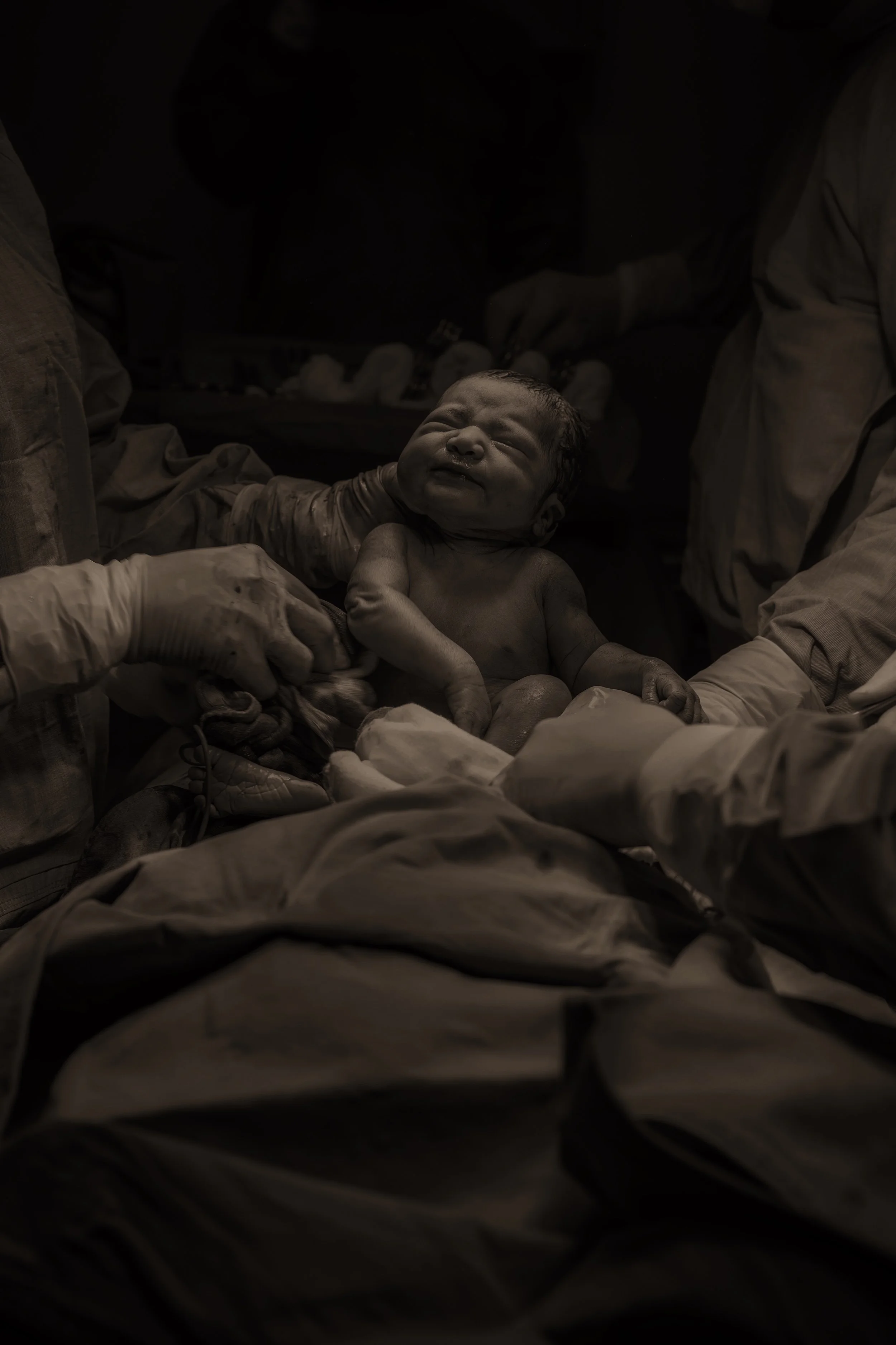 Een pasgeboren baby wordt geboren, omringd door artsen en medische begeleiders.