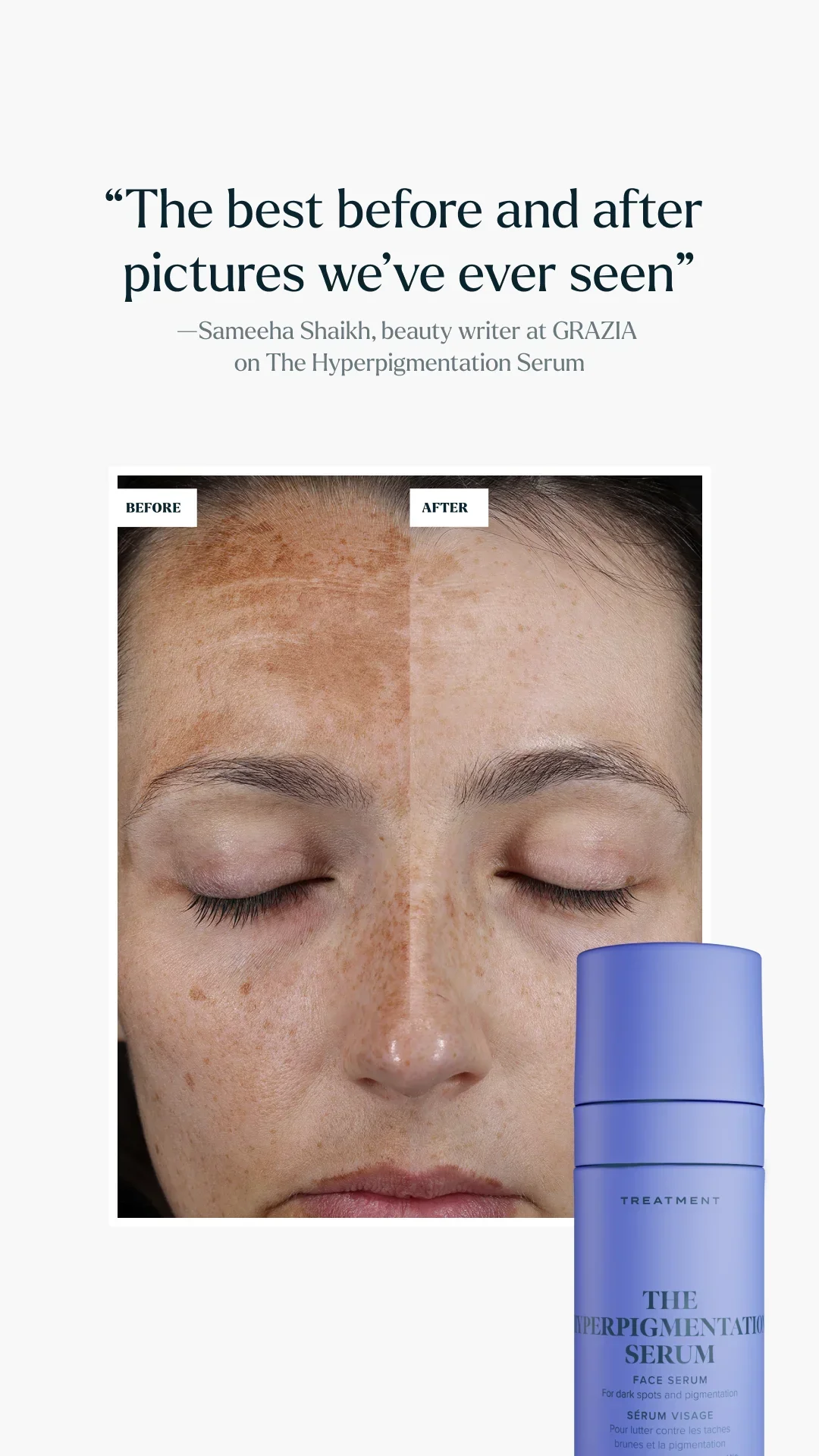 Story_Paid_TheHyperpigmentationSerum_Grazia - 1080 x 1920.webp
