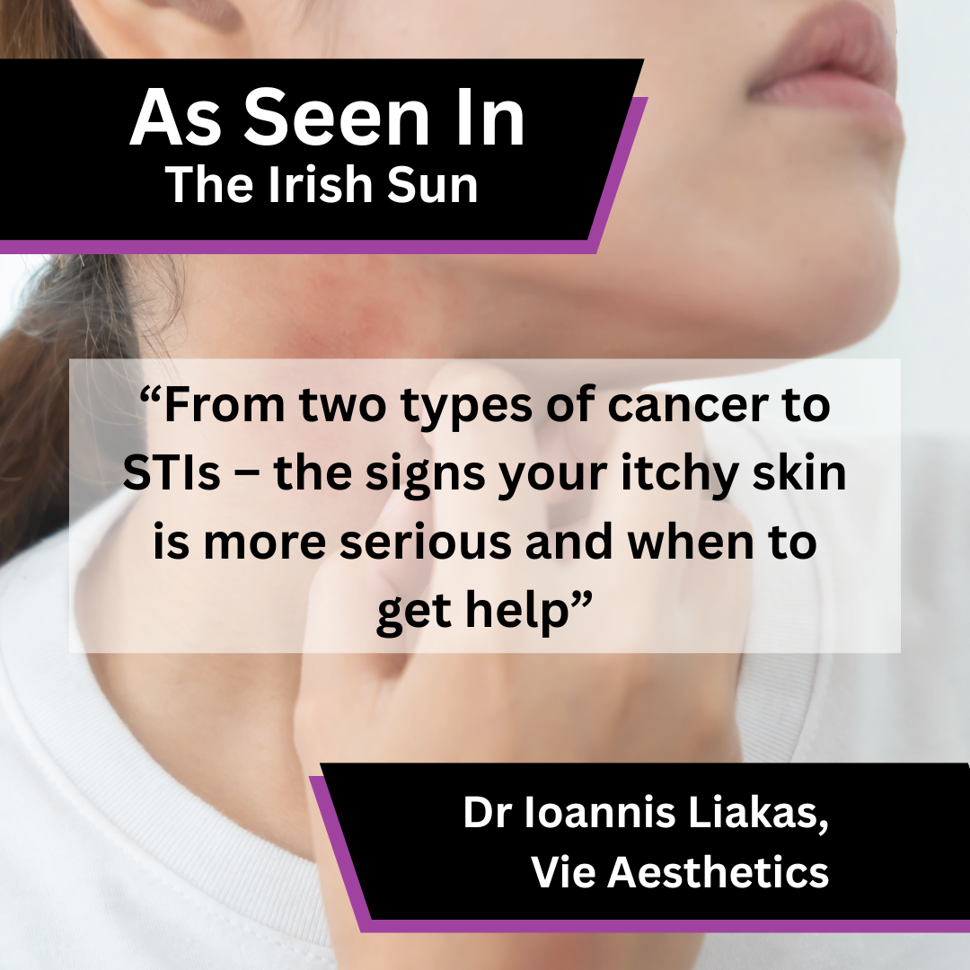 Vie Aesthetics Shares Itchy Skin Health Advice in The Irish Sun - Template 1.png
