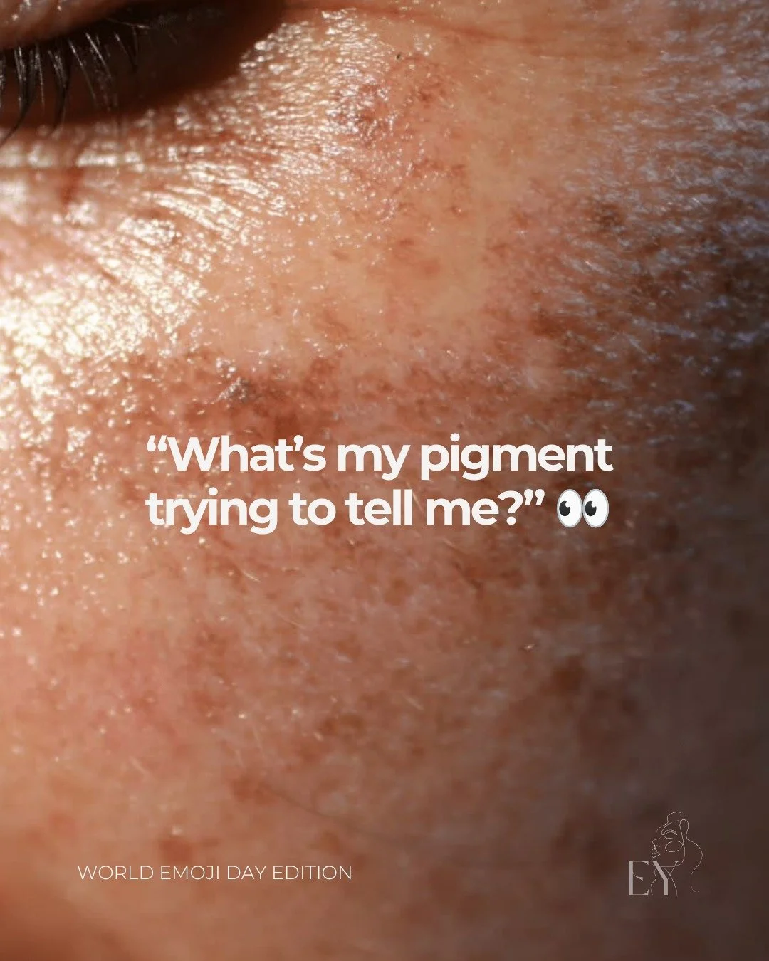 In honor of World Emoji Day, let&rsquo;s translate what your pigment might be trying to tell you.

Sometimes dark spots are not just &ldquo;stubborn&rdquo; 🥵

They&rsquo;re reacting to ☀️ sun, 🔥 heat, ♨️ inflammation, 🆘 picking, or 🧴 the wrong pr