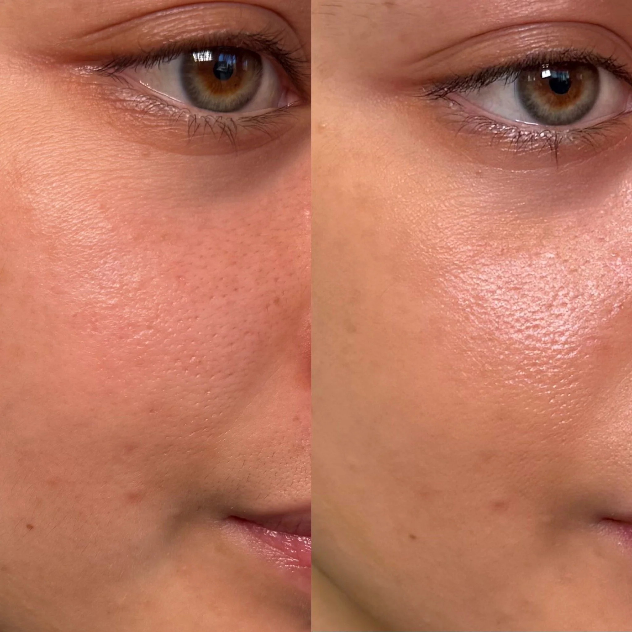 Close-up of a person's eyes with one eye showing and the other partially closed, with natural skin and eyebrow details.