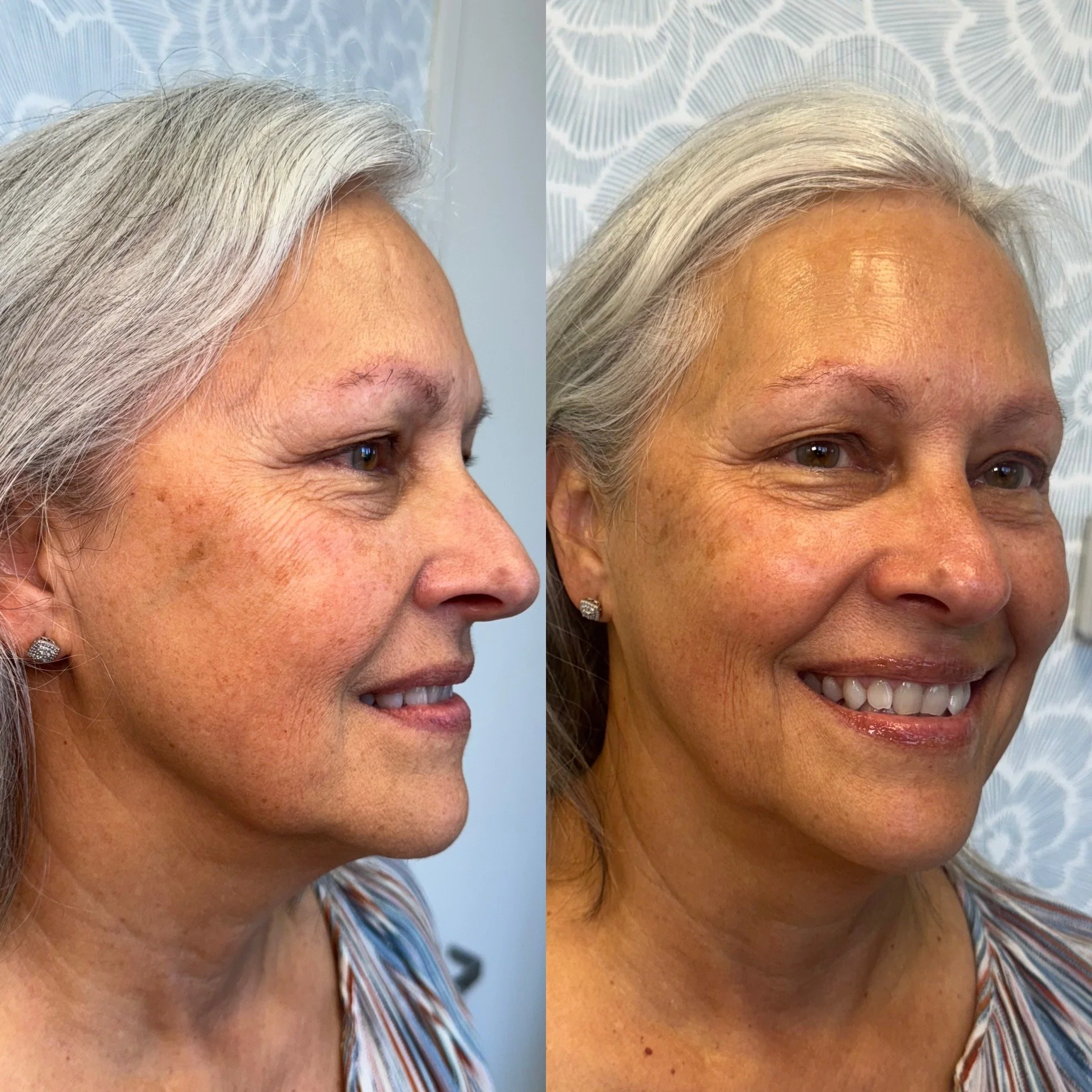 Close-up of a woman with silver hair, showing before and after hair treatment results on one side of her face.
