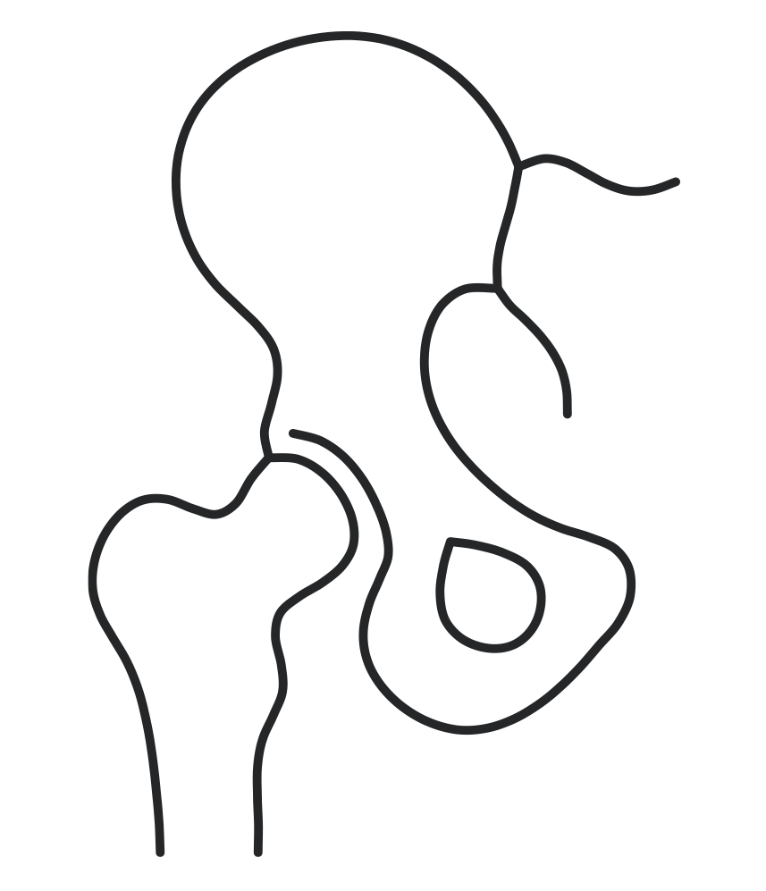 A black line drawing of a human pelvis and hip bones on a black background.