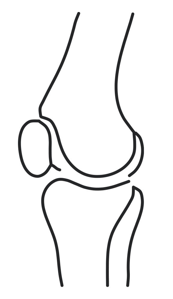 Outline drawing of a human knee joint, including the femur, tibia, patella, and cartilage.
