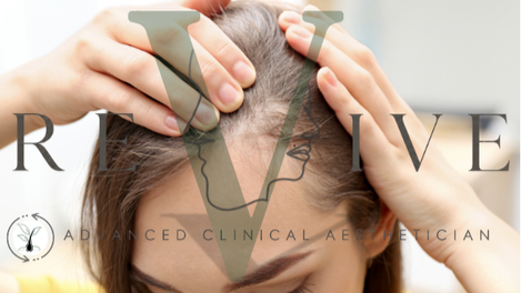 Close-up of a woman receiving a scalp treatment from a practitioner, with overlay text reading 'VIVE Advanced Clinical Aesthetic'. Hair loss pregnancy hormone hormonal changes hair loss prevention regrowth