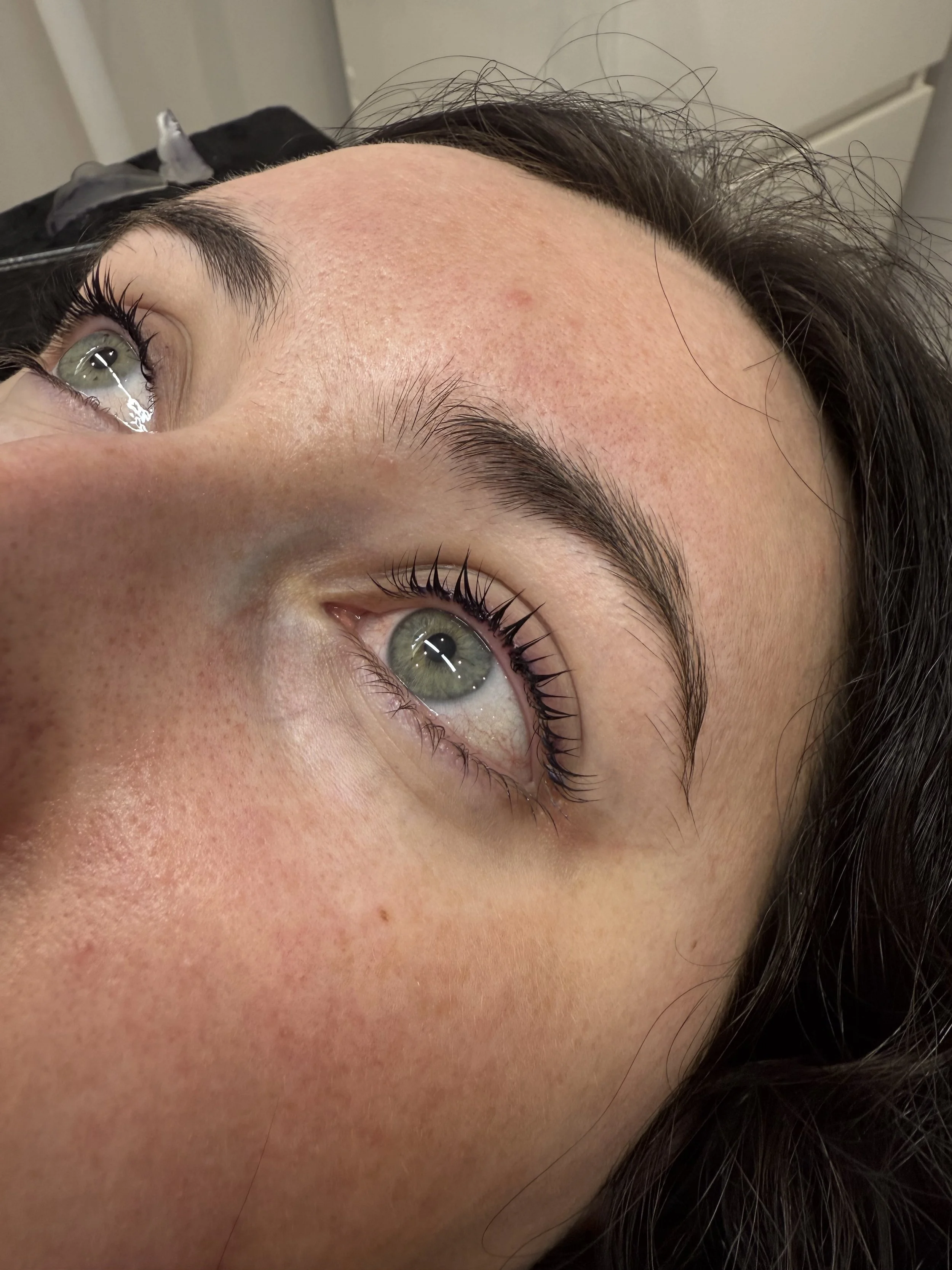 Close-up of a woman's face with green eyes, dark eyelashes, and well-groomed eyebrows. The skin on her forehead shows some redness and small blemishes. Her dark hair is partially visible.