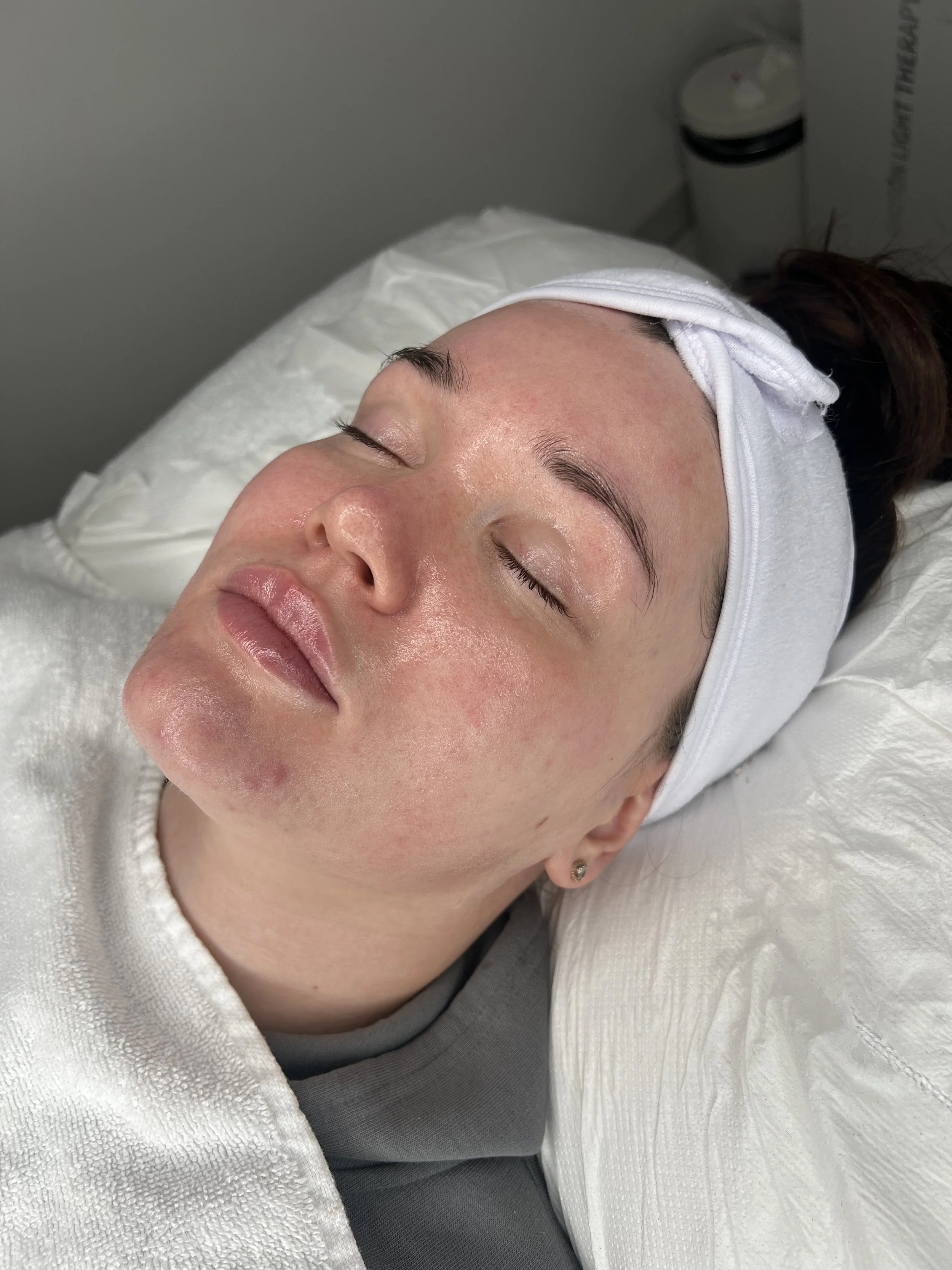 A woman with dark hair, lying down on a treatment bed with her eyes closed, receiving a facial treatment in a spa or clinic setting.