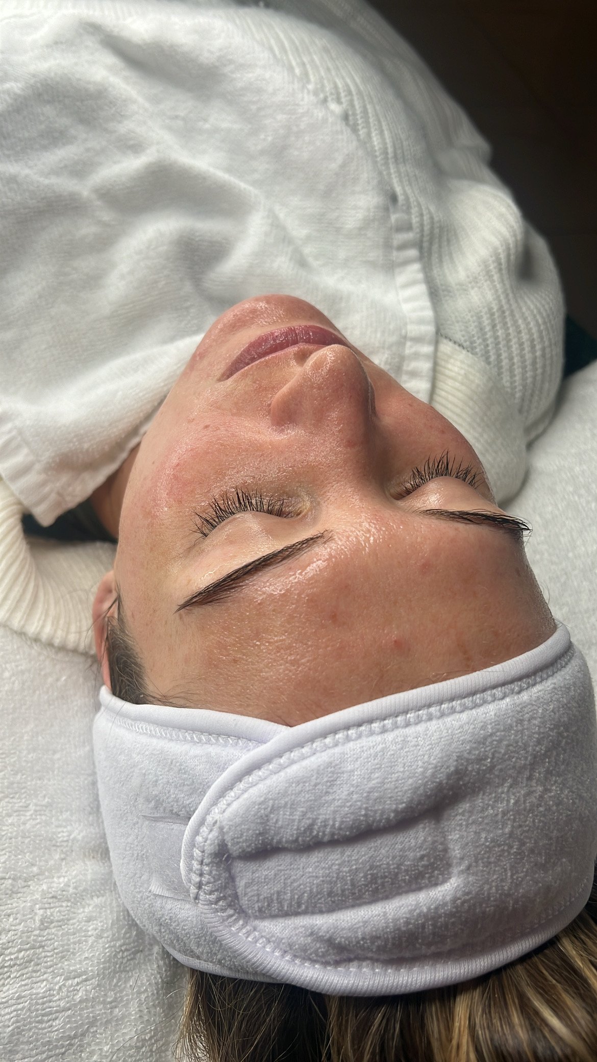 Close-up of a woman with her eyes closed, lying down with a white headband and a white sweater, receiving a facial treatment in a clinical setting.