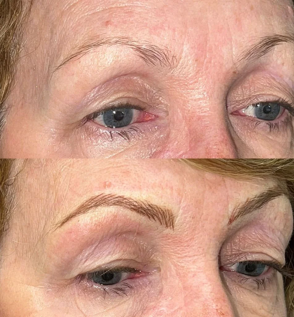 Close-up of a woman’s face before and after microblading treatment.