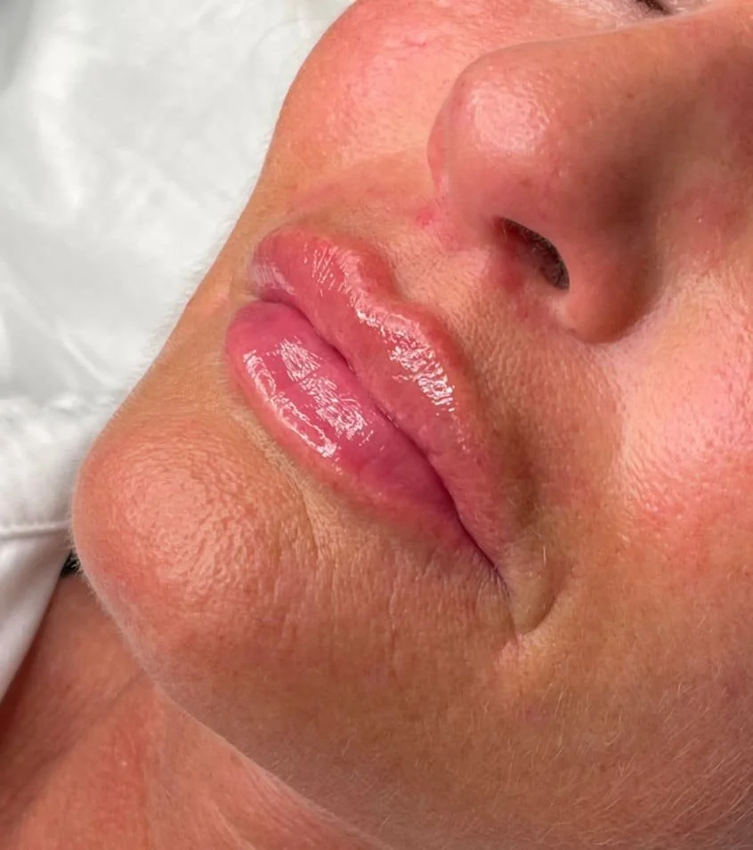 Close-up image of a person's lips and nose, showing shiny, glossy lips and part of the nose.