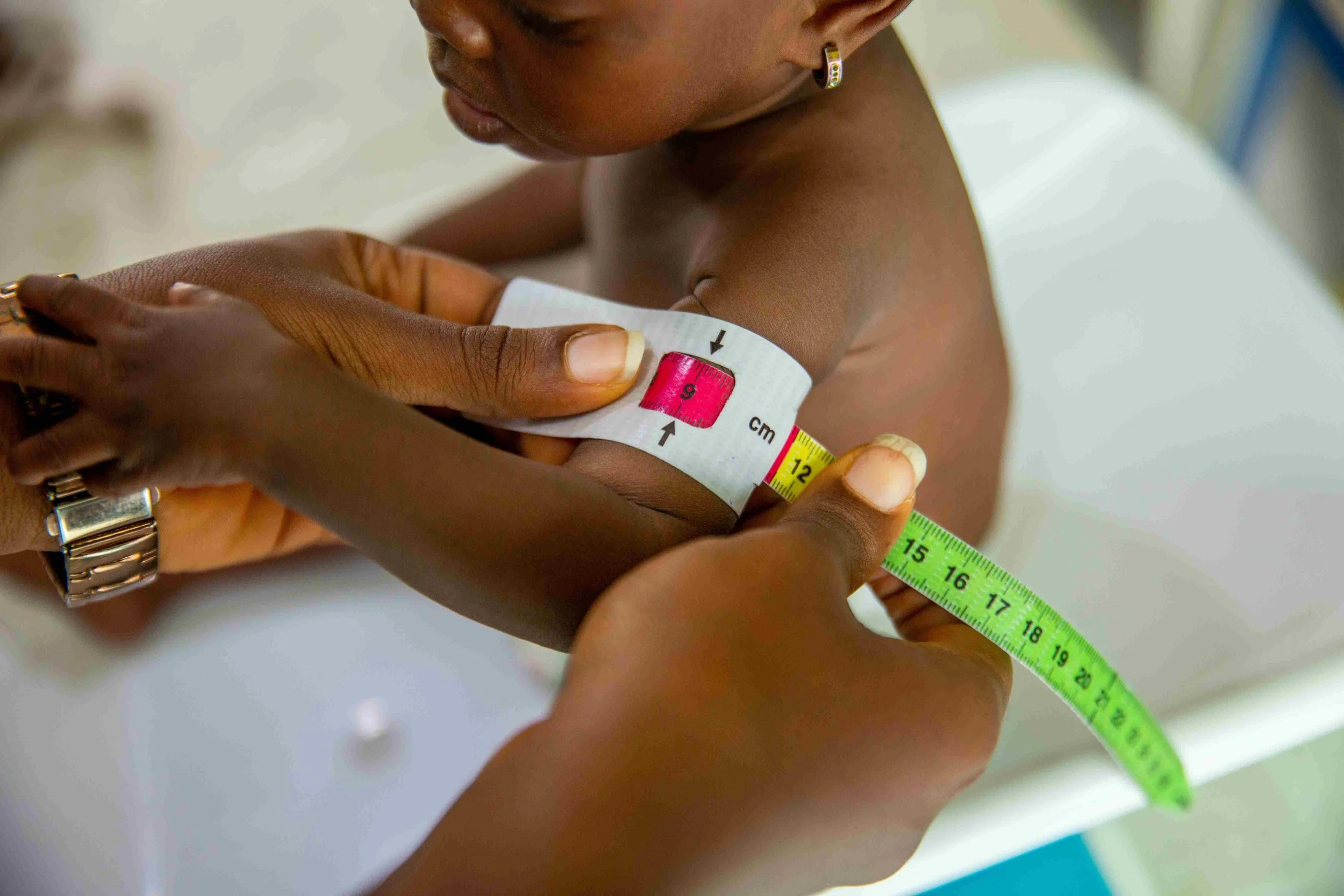 A person measures a child's upper arm with a white measuring tape, which is wrapped around the arm, showing a measurement of approximately 12 centimeters. The child's skin is dark, and the scene takes place indoors with a blurred background.