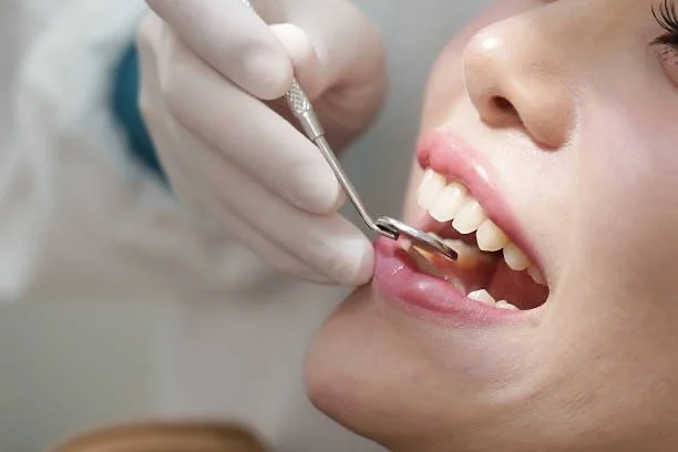 Close-up of a person receiving dental care from a dental professional, with the patient's mouth open and dental tools used for examination.