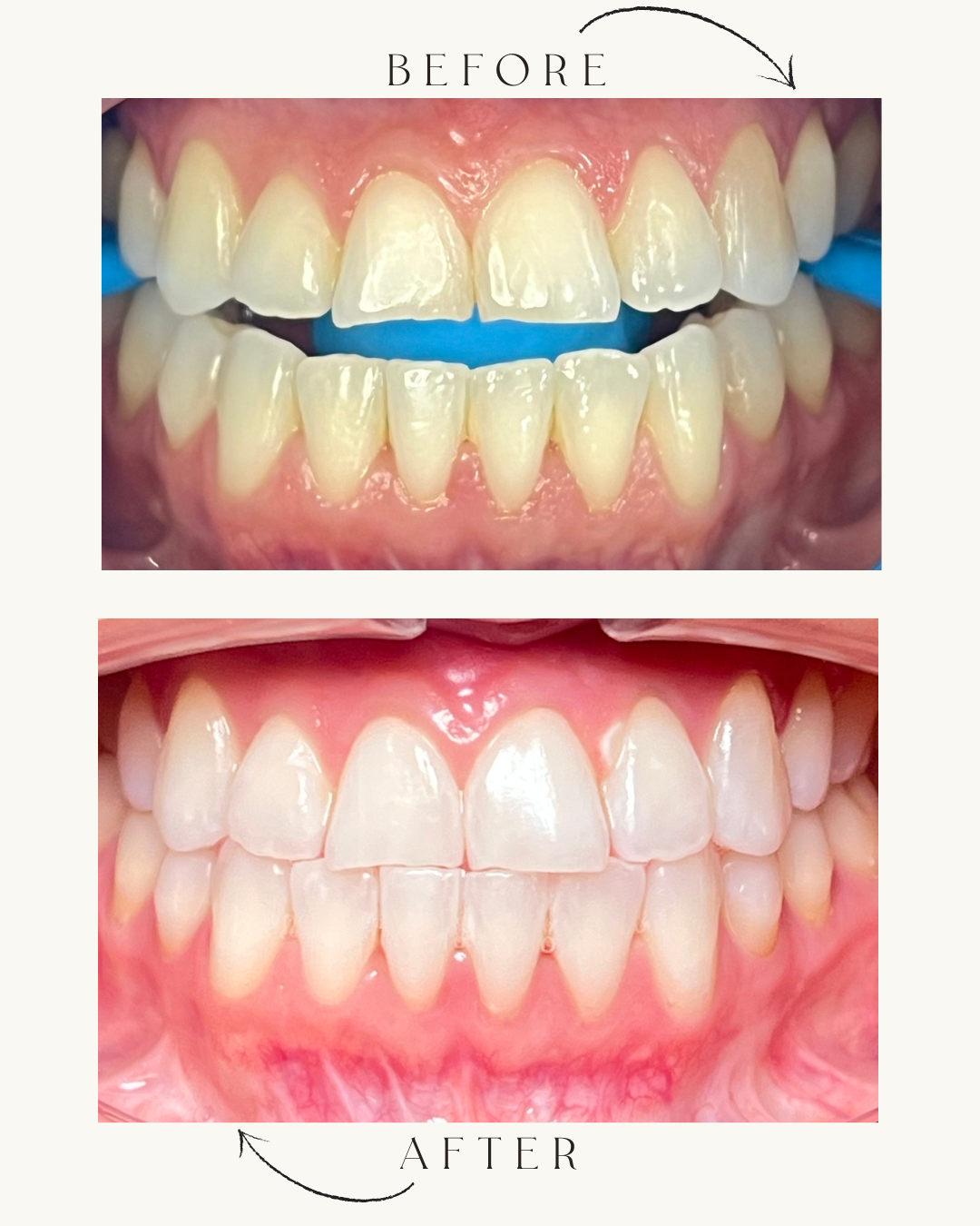 Green and Beige Minimalist Skincare Before After Collage Instagram Post 3.PNG