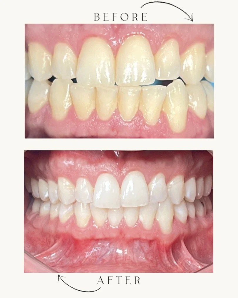 AngelAbreu030791Before& After.JPG