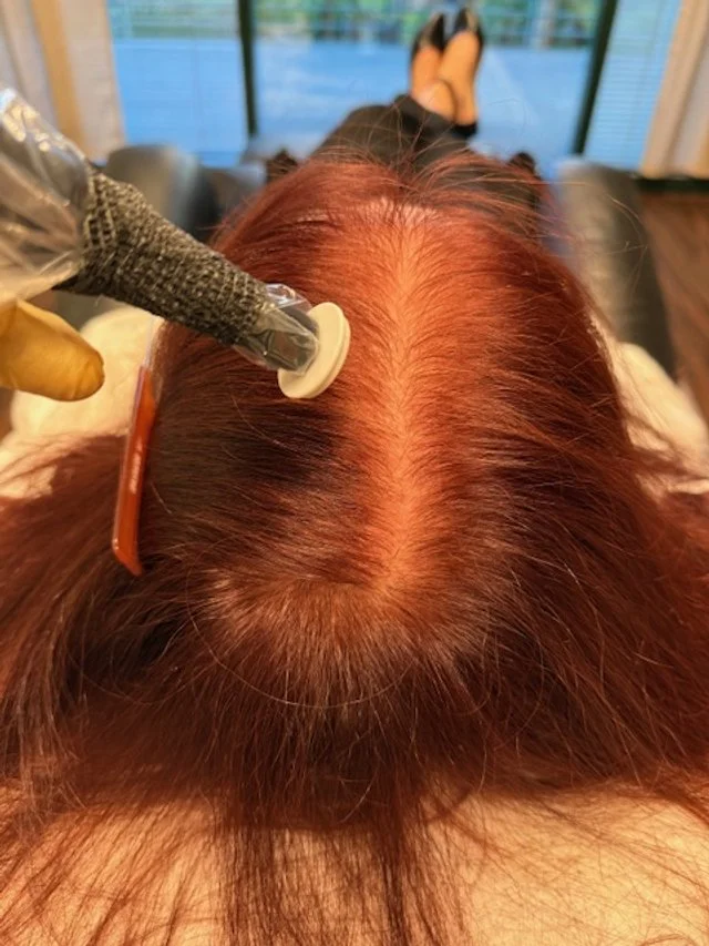 Procell MD Microchanneling Hair Regrowth