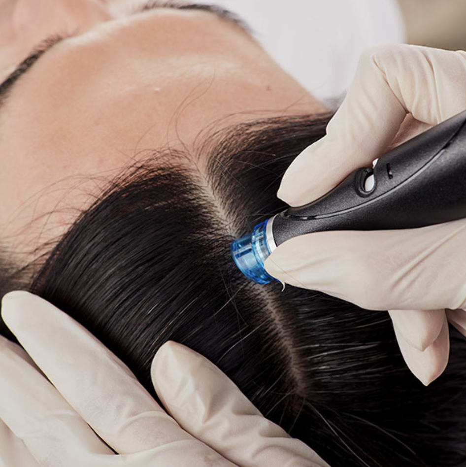 Scalp Treatments