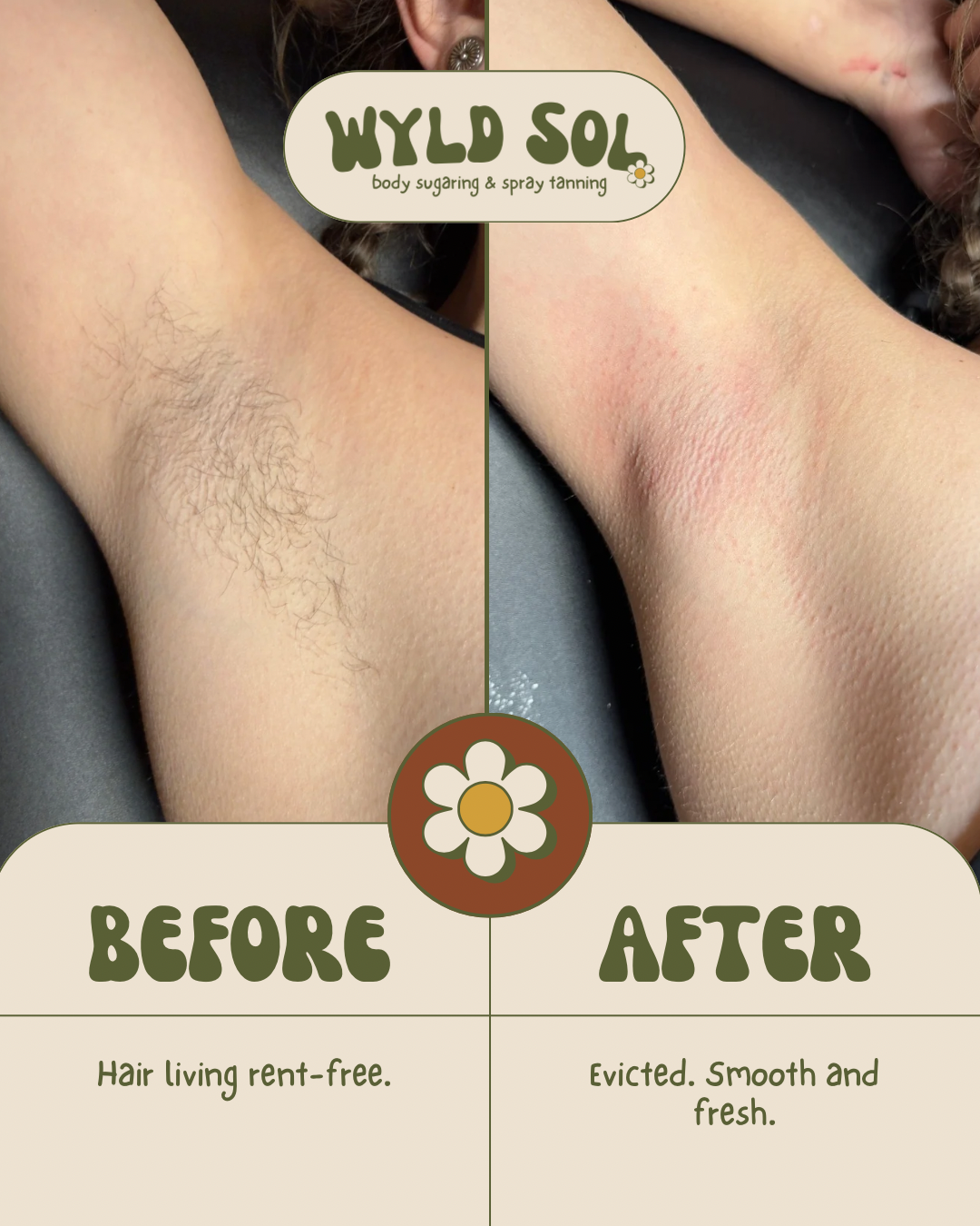 Copy of Copy of Wyldsolbodysugaring.png