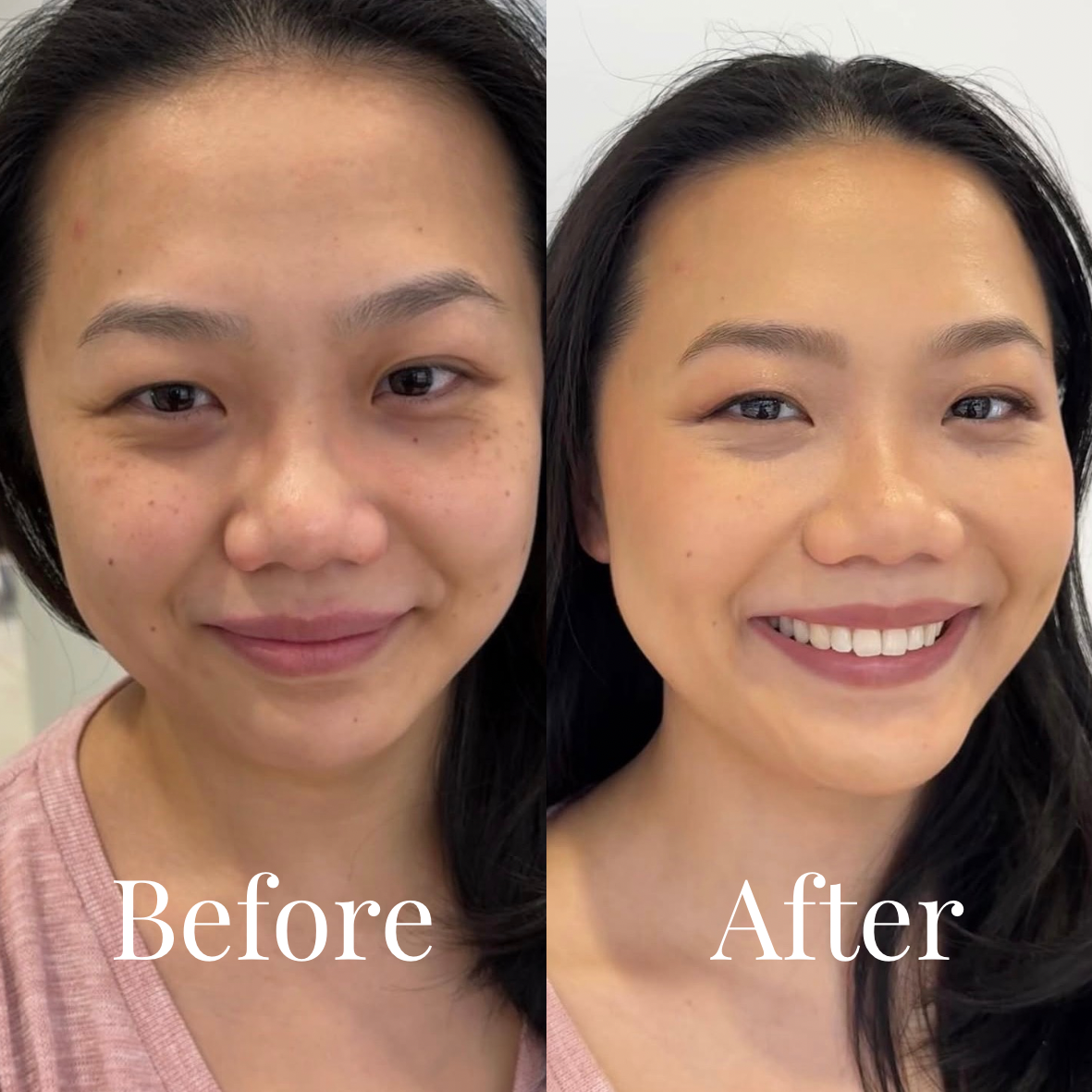 Side-by-side comparison showing a woman before and after skincare or makeup application, with visible skin improvements in the after photo, smiling in both images.